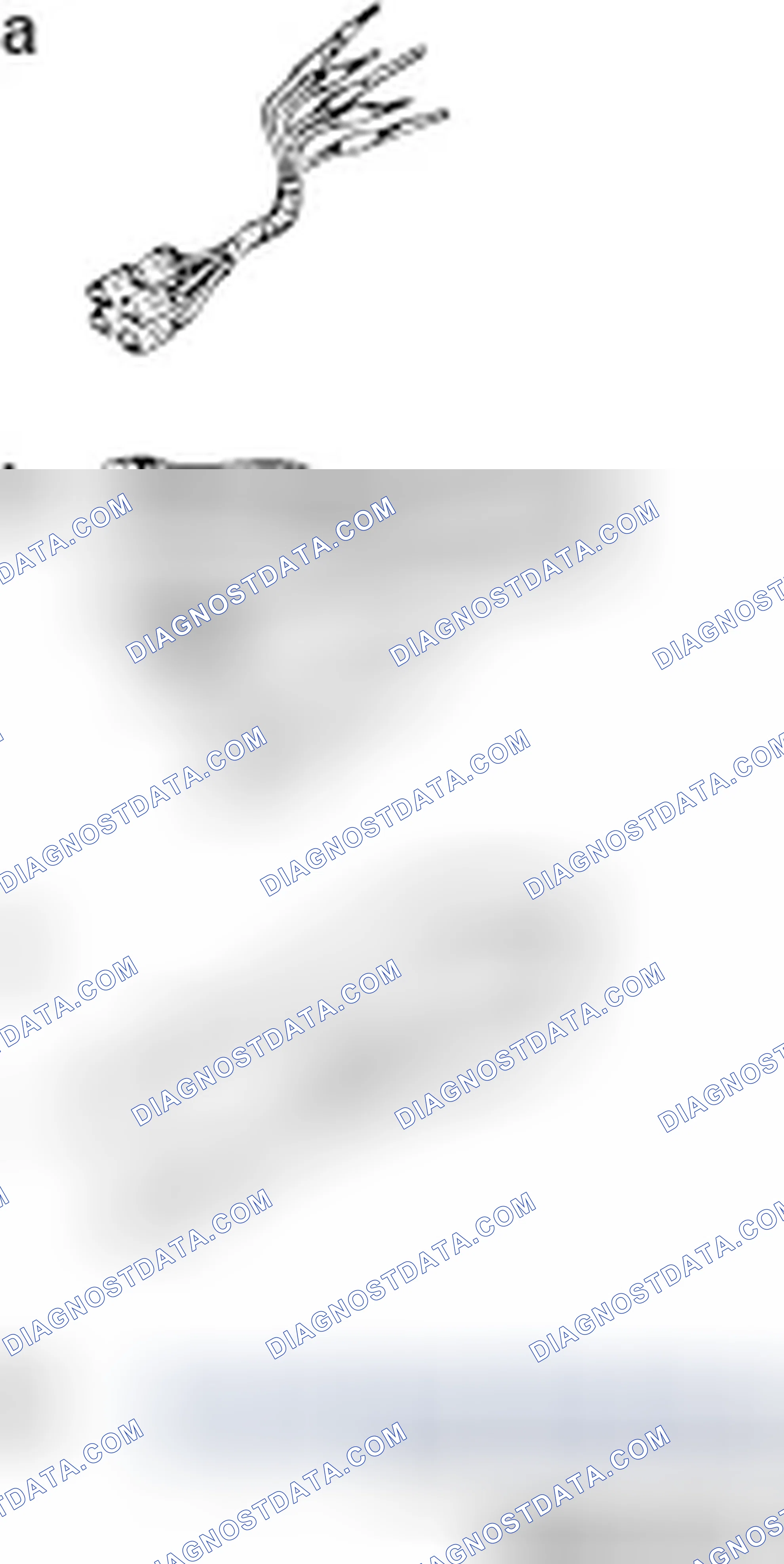 Scheme 374: SPECIAL TOOLS