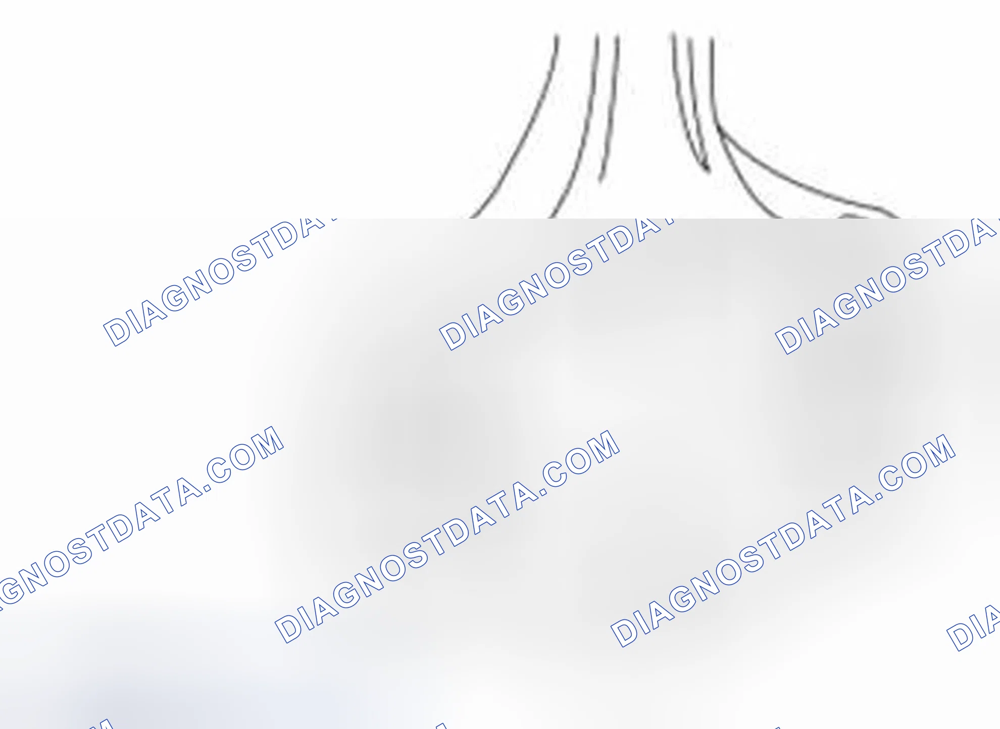 Scheme 327: Connecting Rod Large End Bore