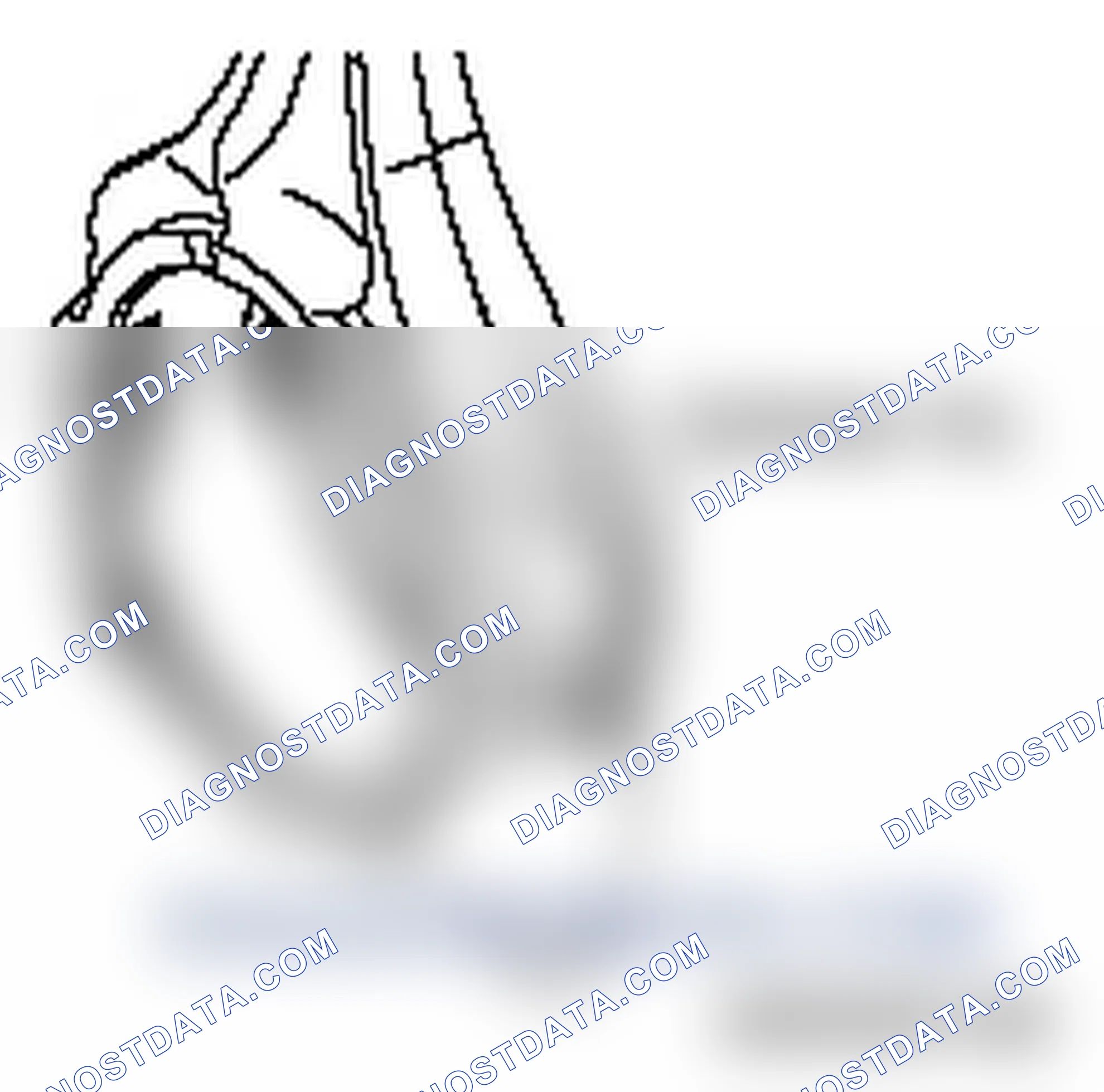 Scheme 467: << A >> CONNECTING ROD/CONNECTING ROD CAP REMOVAL