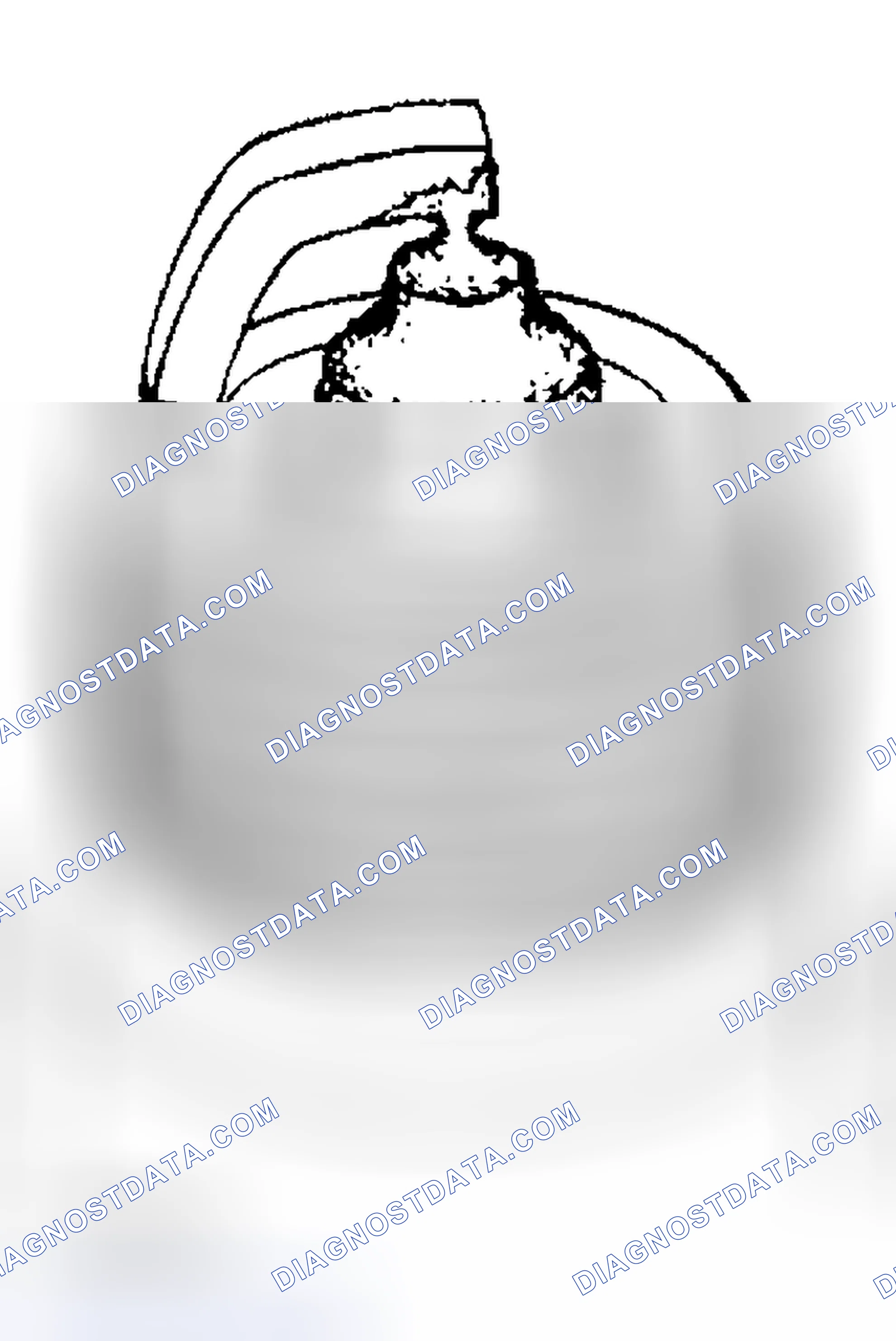 Scheme 75: Spark Plug - Inspection