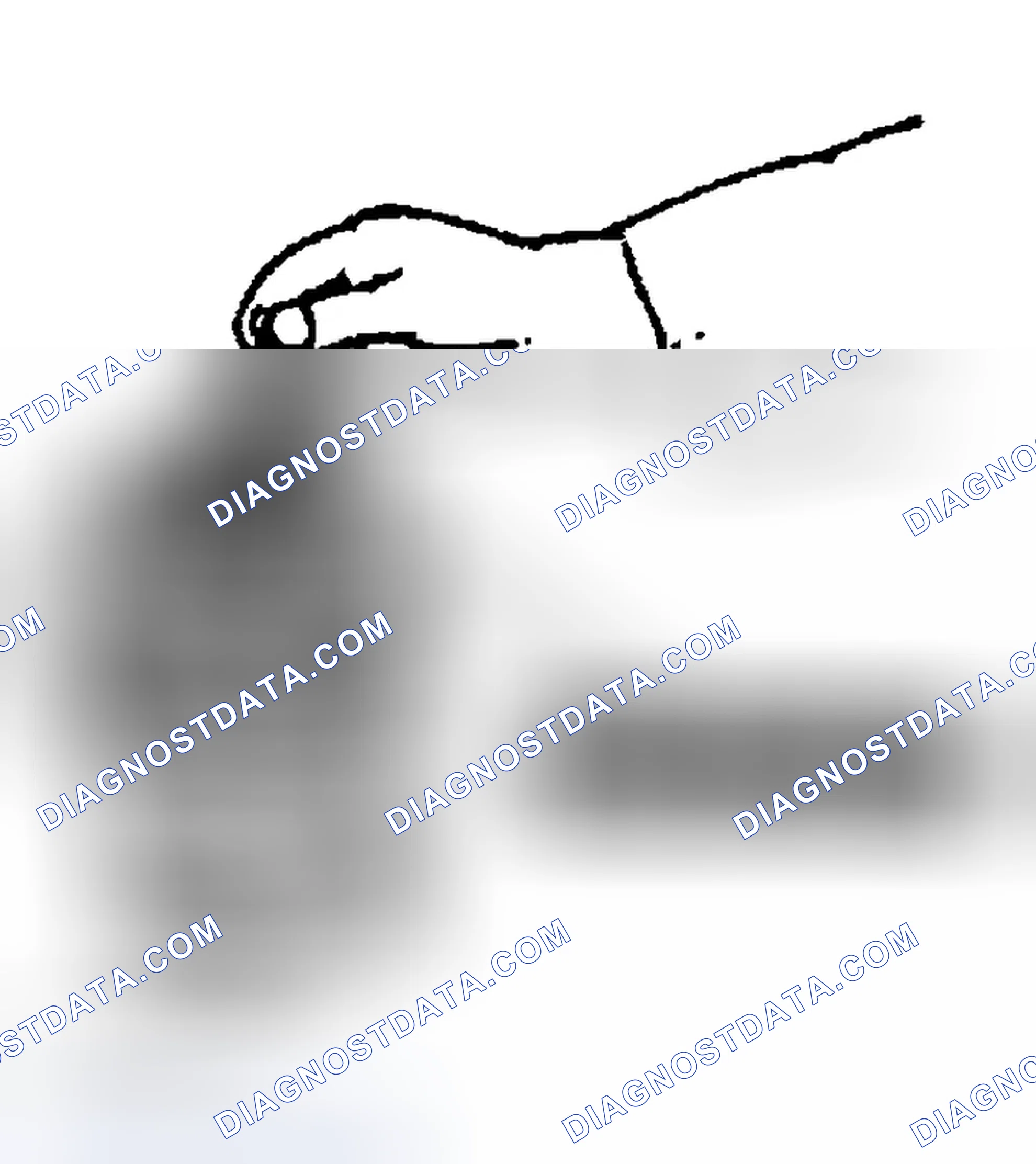 Scheme 100: Pressure Plate Disassembly Note