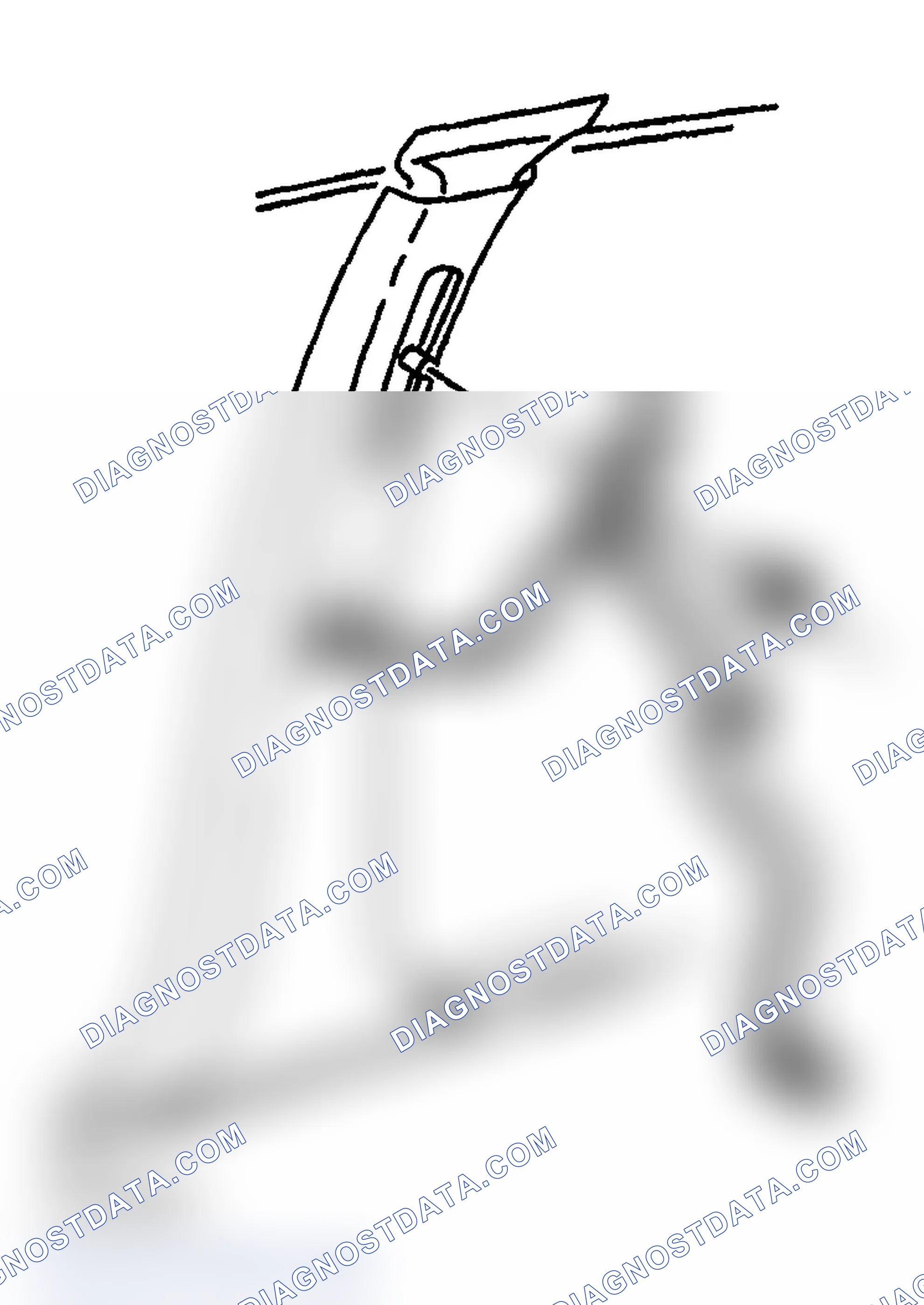 Scheme 25: Removal Procedure