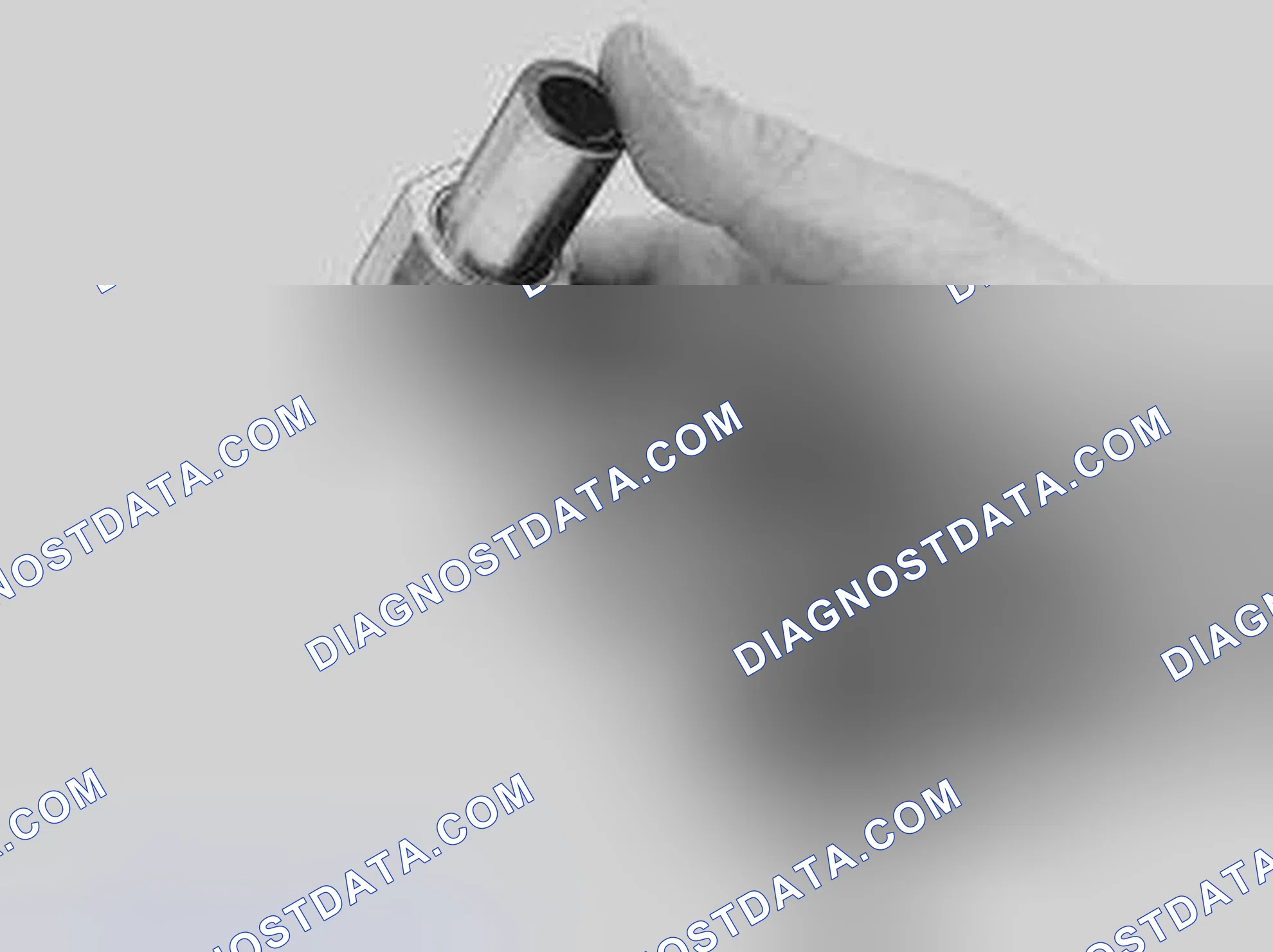 Scheme 243: CHECKING THE ALIGNMENT OF THE PISTON PINS IN THE CONNECTING RODS