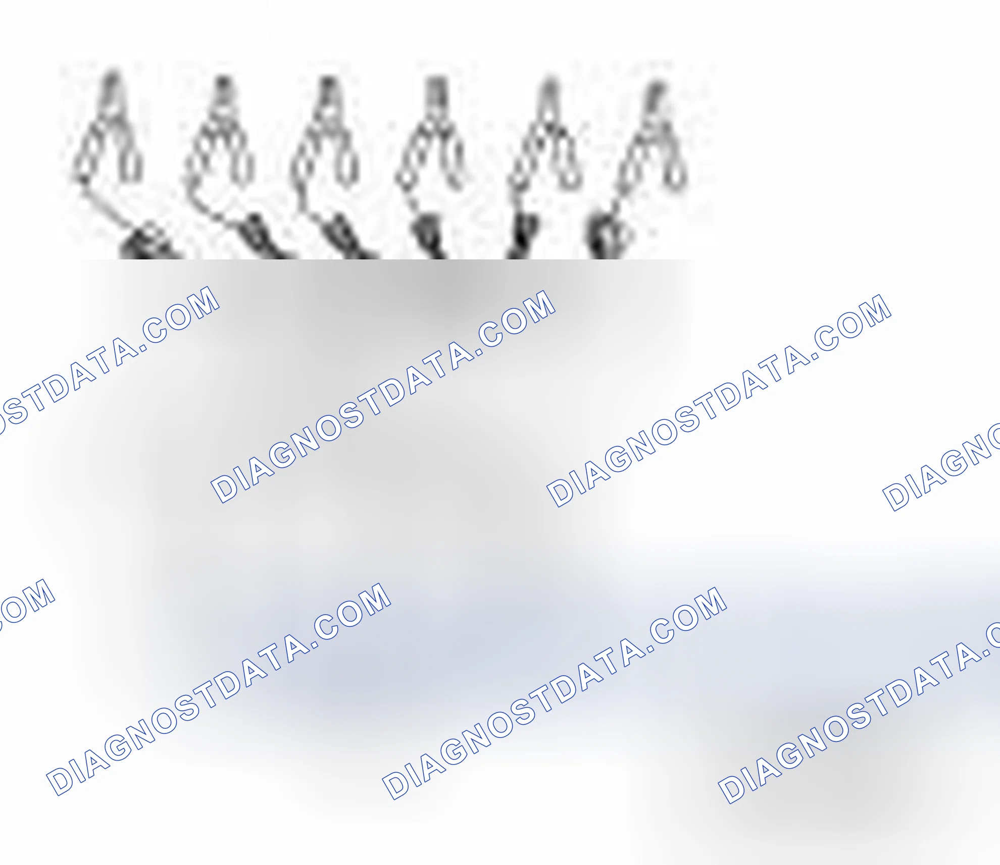 Scheme 62: Special Service Tools