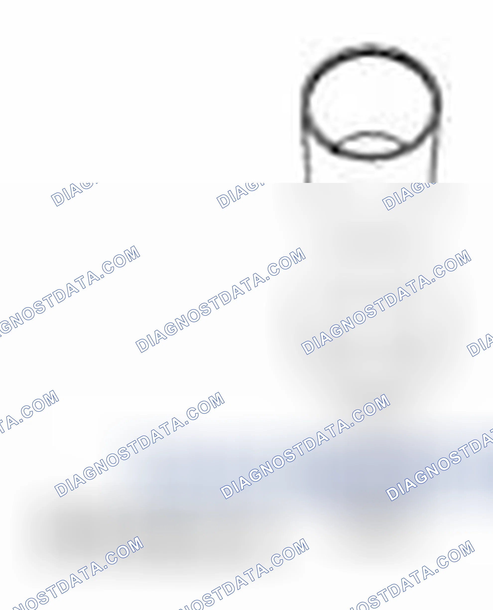 Scheme 50: Subframe Bushings - Differential, Rear