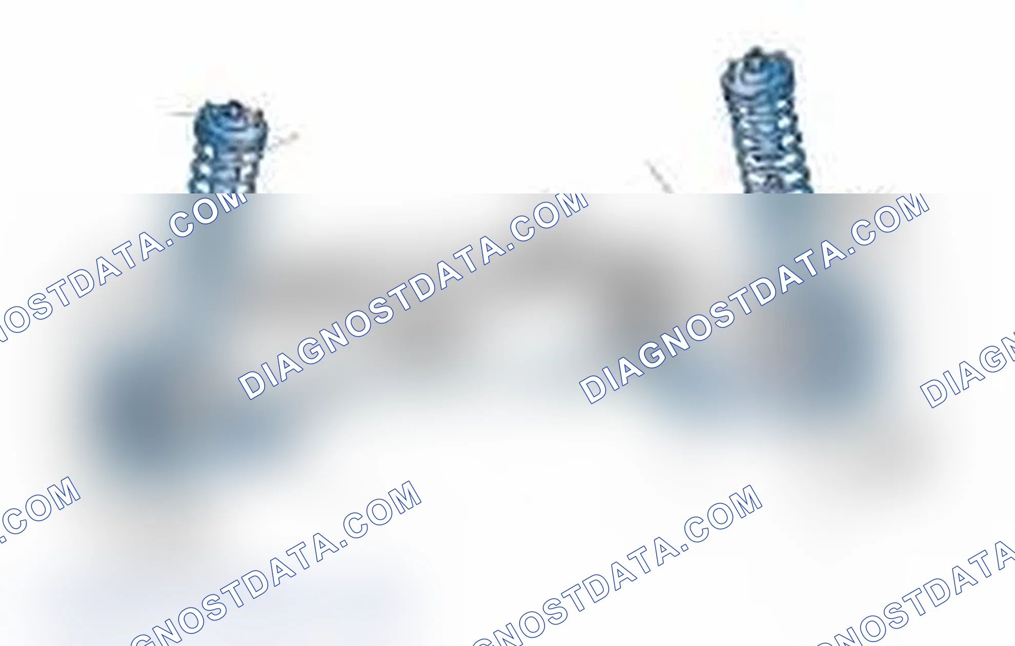 Scheme 25: Typical Front Suspension & Steering Components