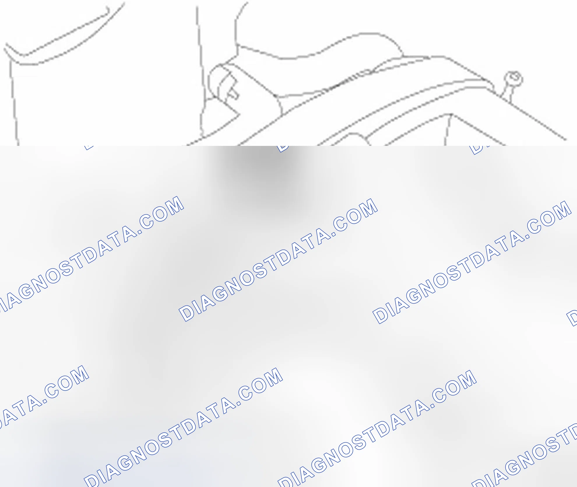 Scheme 5: POSITIVE CRANKCASE VENTILATION (PCV) SYSTEMS