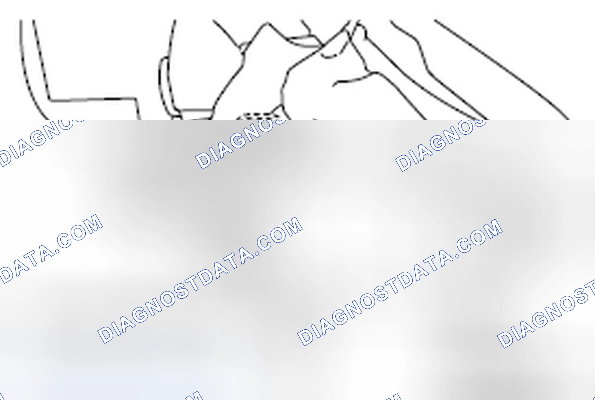 Scheme 5: REPAIR PROCEDURE OF BRACKET B