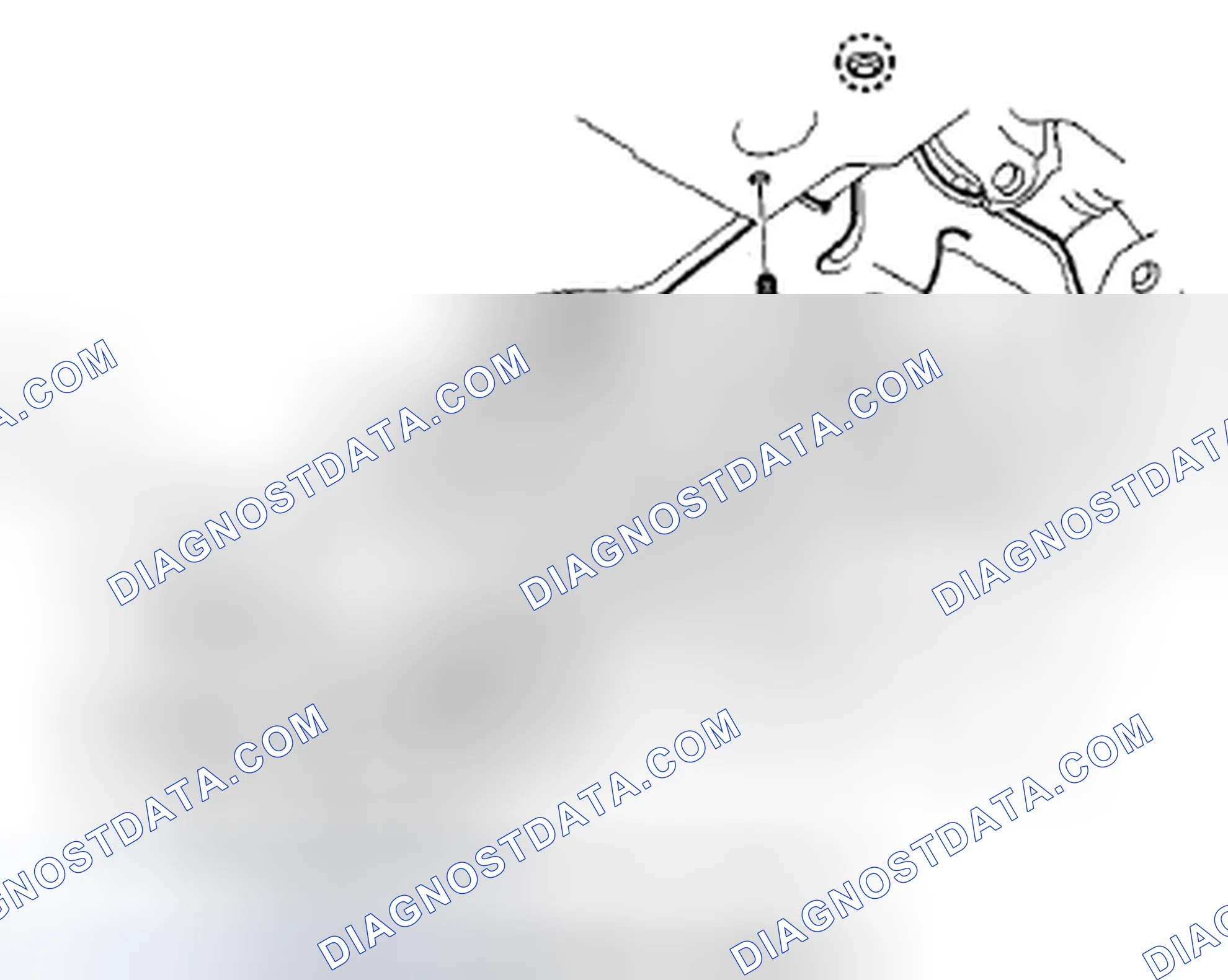 Scheme 38: Stabilizer Bar Replacement
