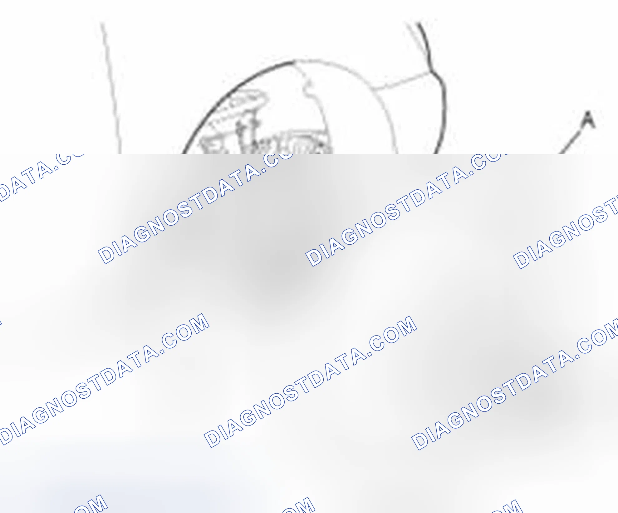 Scheme 2: Removal