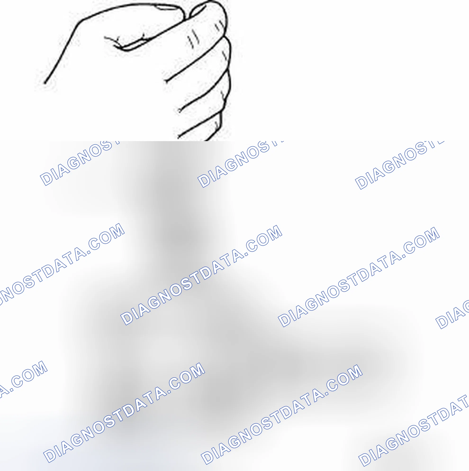 Scheme 37: DISASSEMBLY