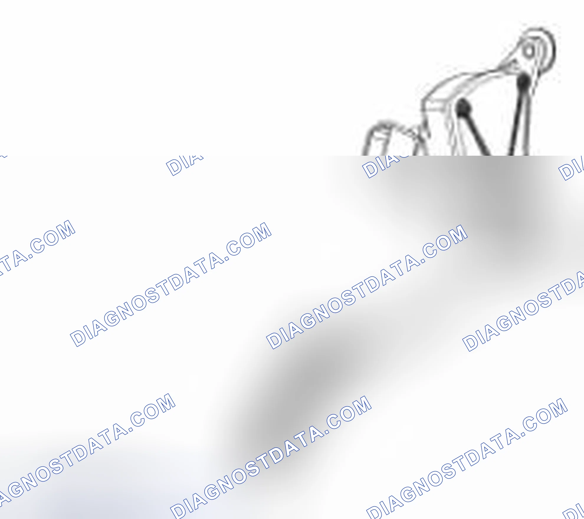 Scheme 18: 3-Track APP Sensor