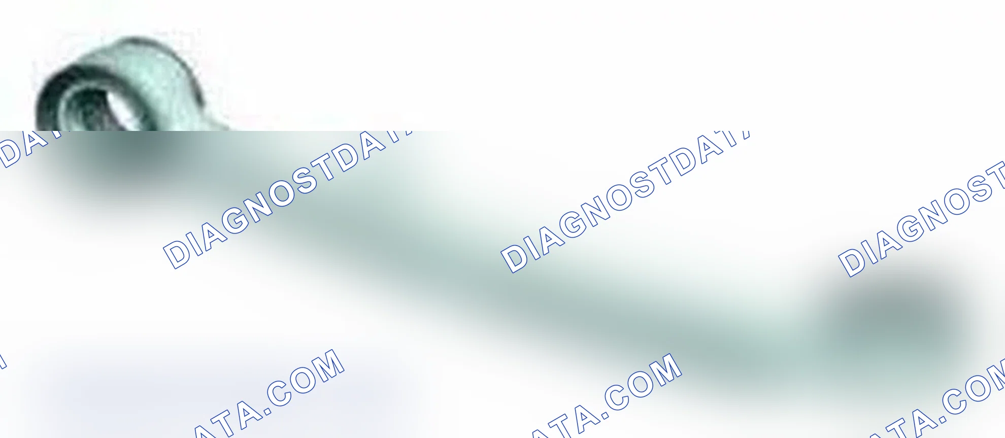Scheme 36: Wishbone
