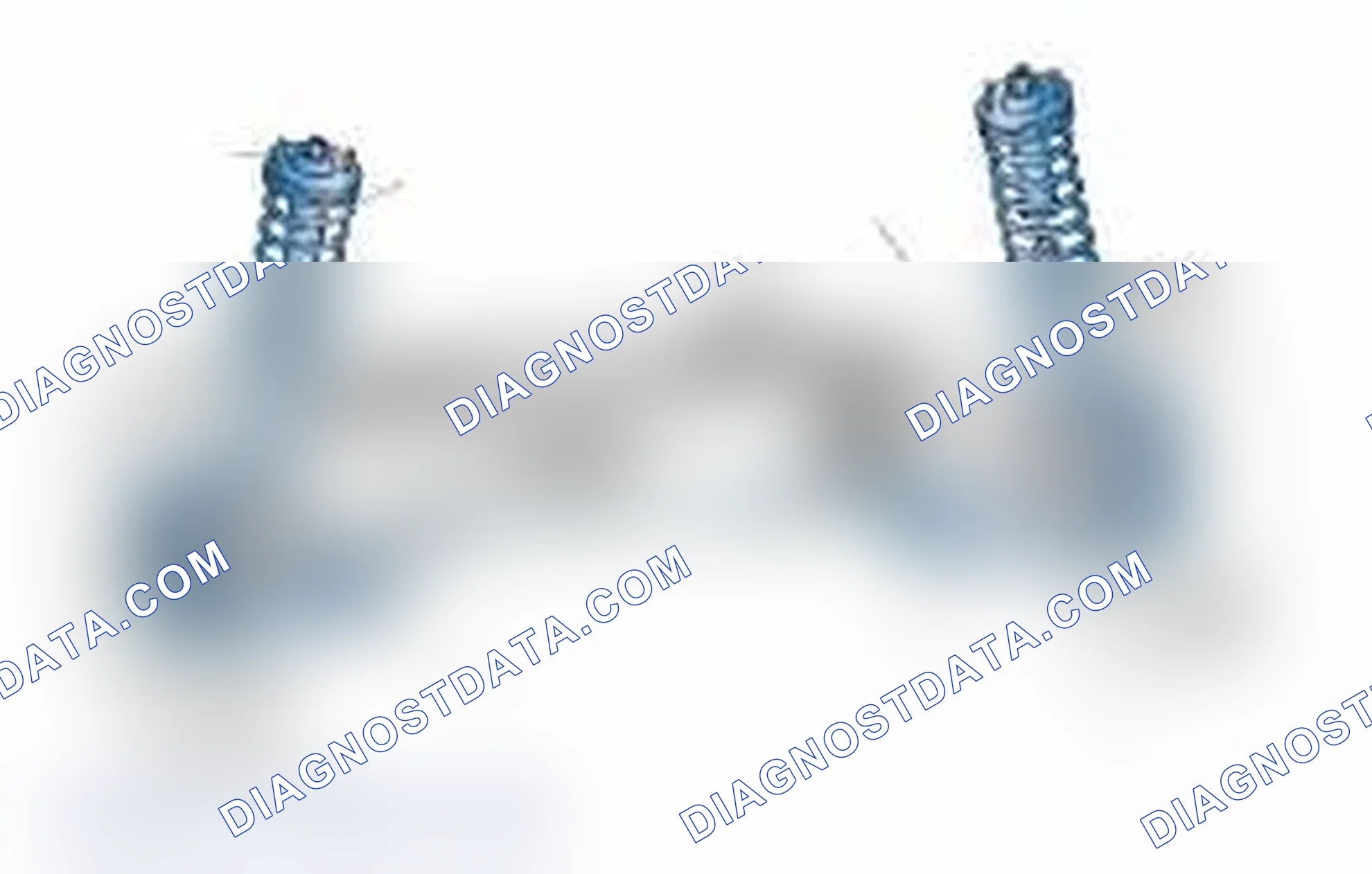 Scheme 25: Typical Front Suspension & Steering Components