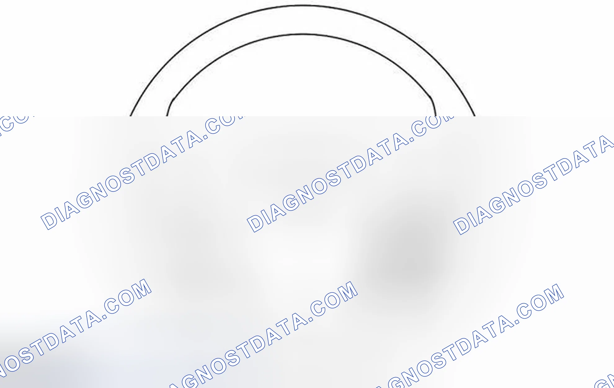 Scheme 2: Speed Control Steering Wheel Switches