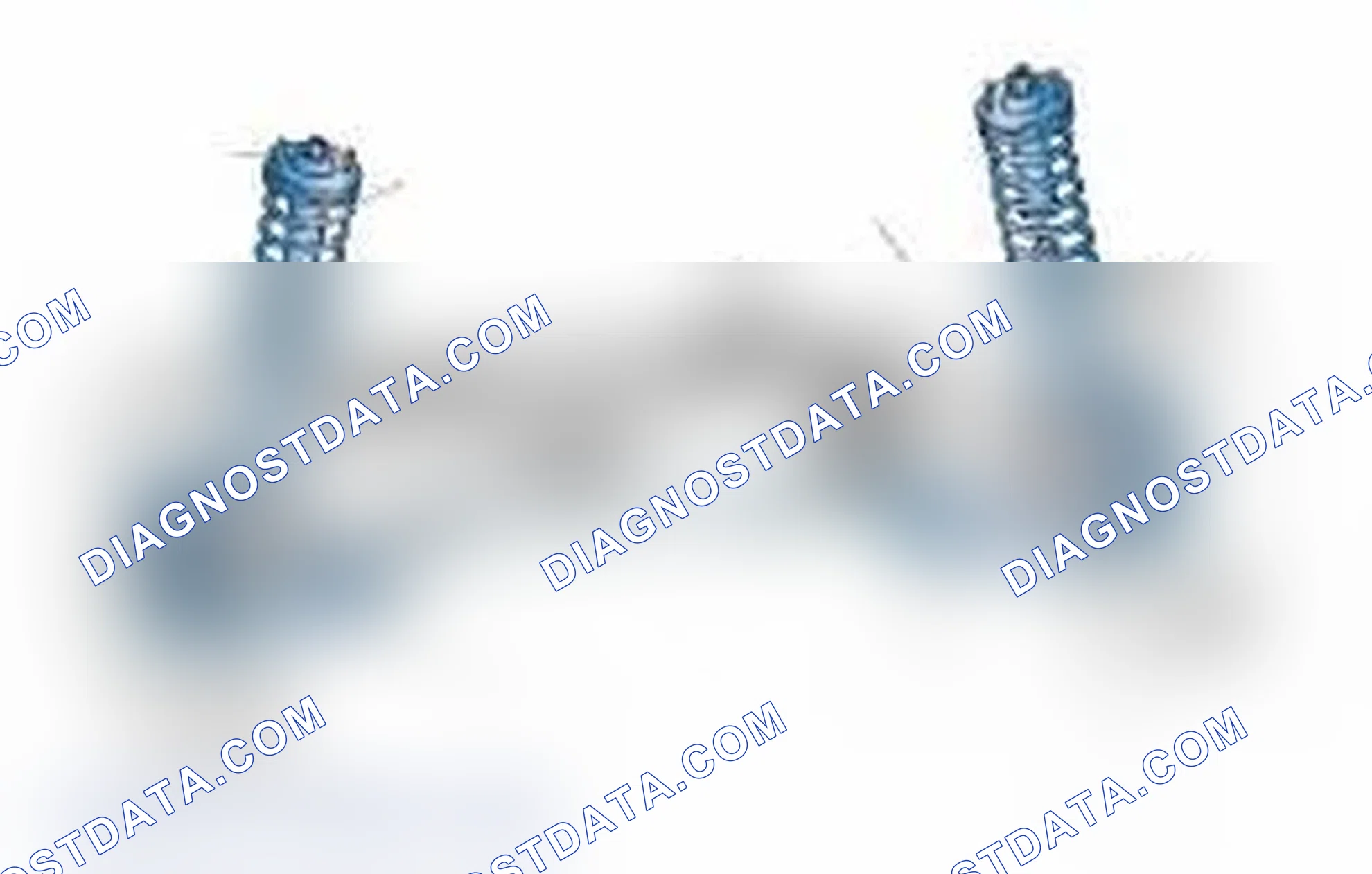Scheme 25: Typical Front Suspension & Steering Components