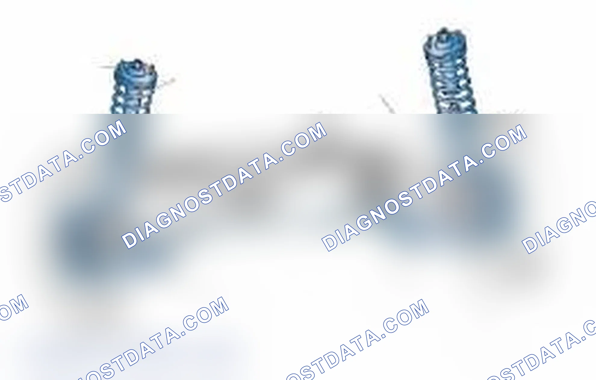Scheme 25: Typical Front Suspension & Steering Components