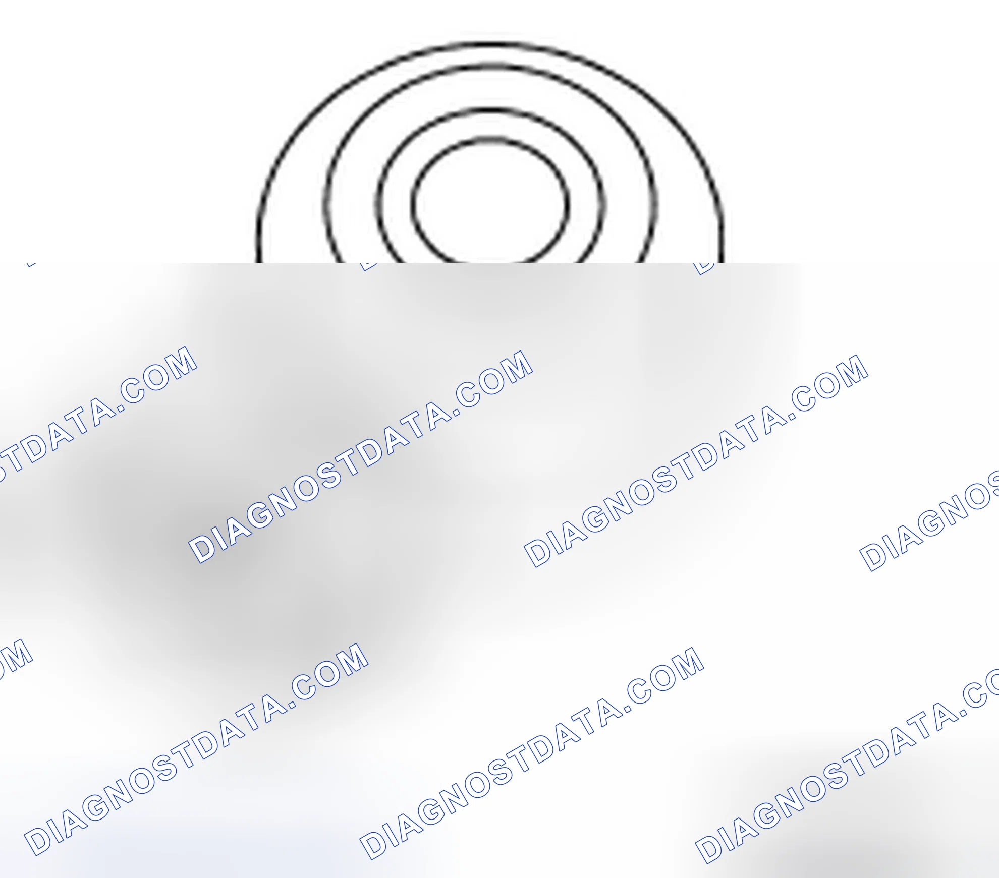 Scheme 93: Knock Sensor