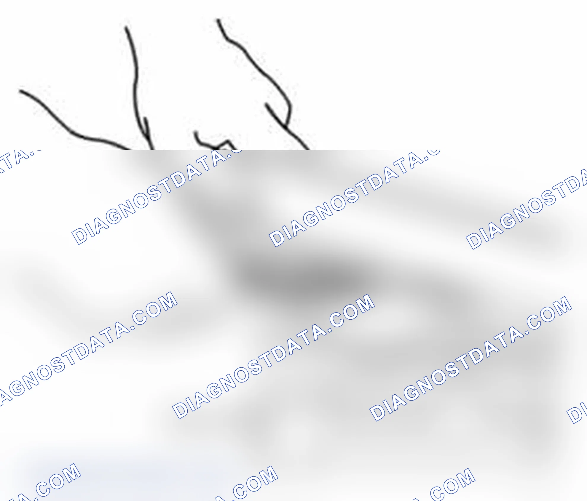 Scheme 478: Distortion of Cylinder Head Mating Surface
