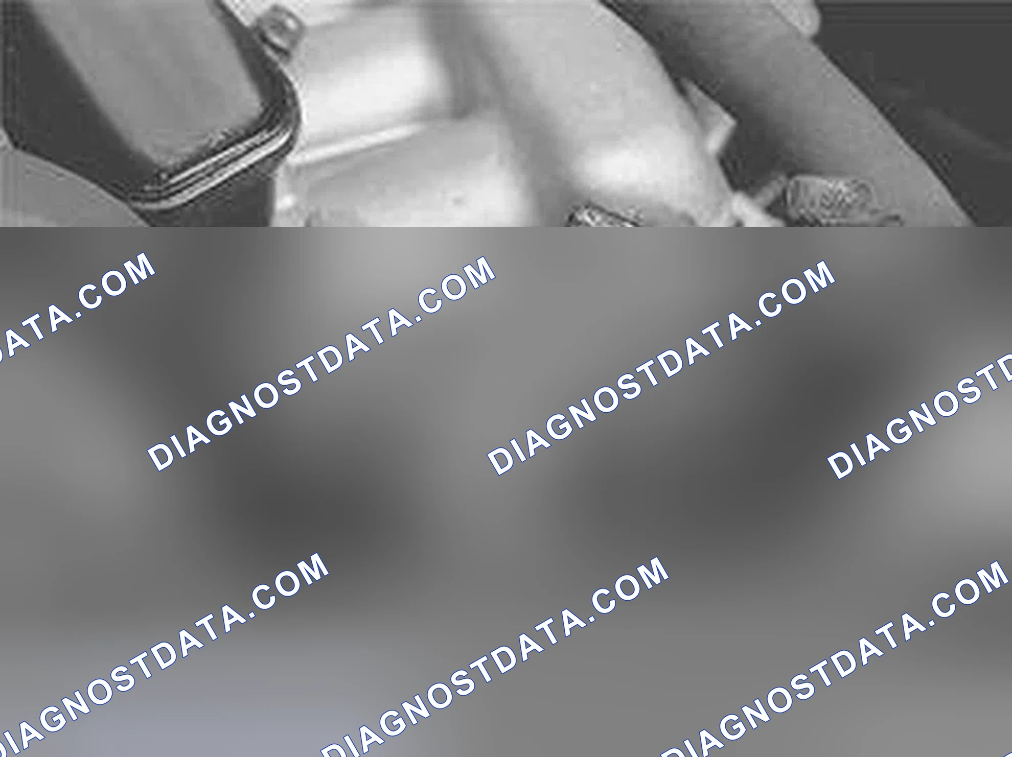 Scheme 178: Compressing The Tensioner / Damping Unit