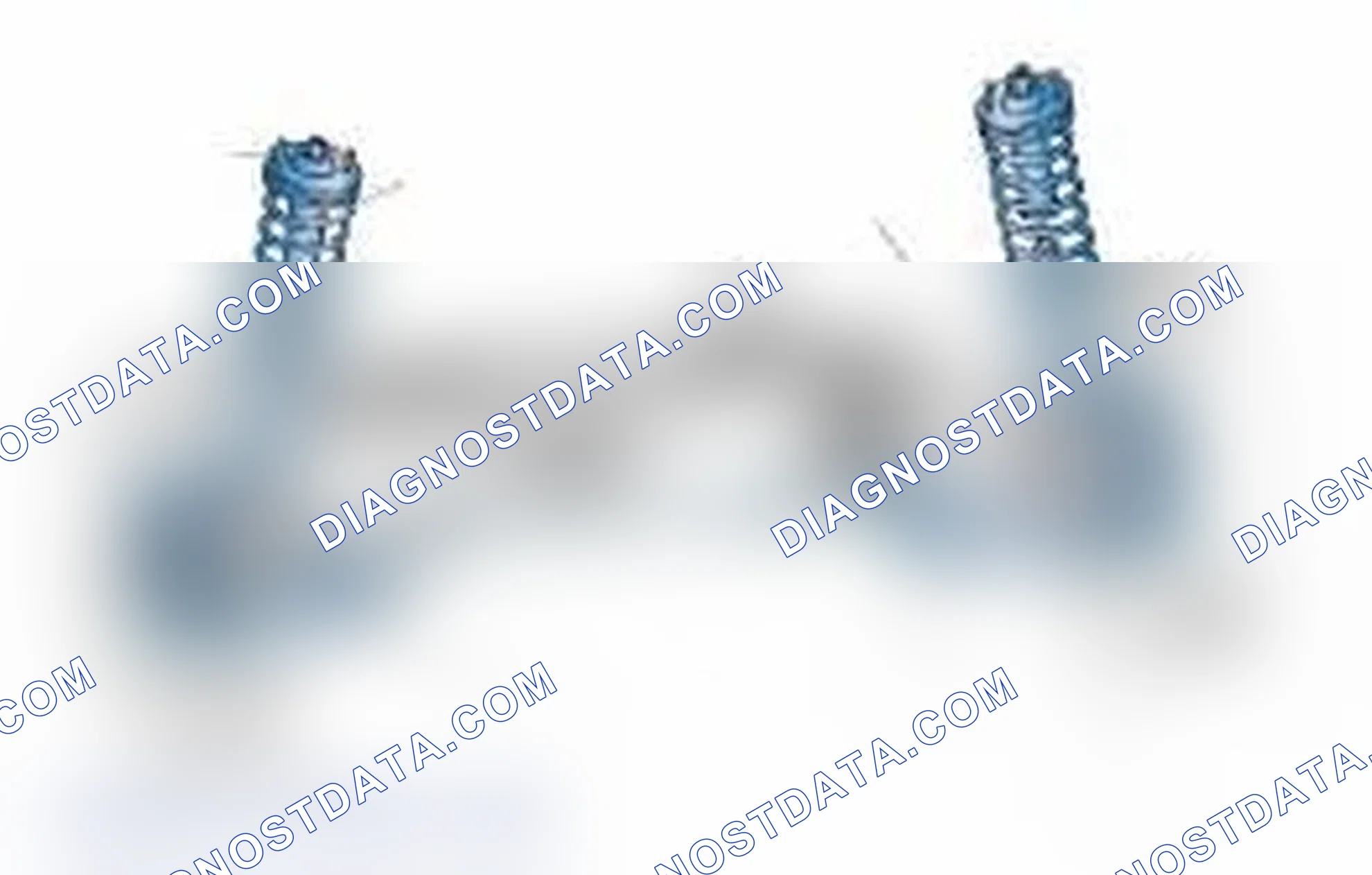 Scheme 25: Typical Front Suspension & Steering Components