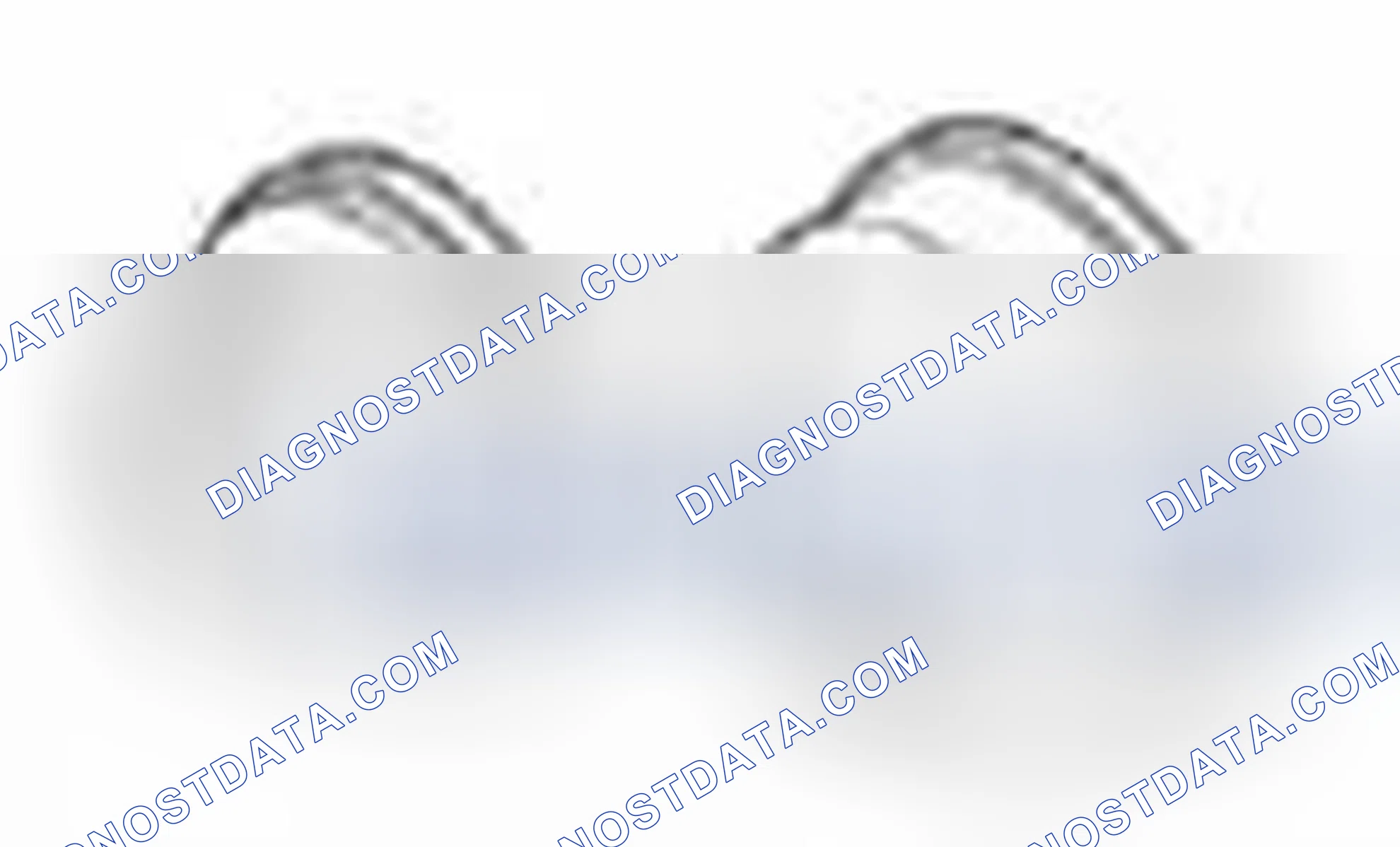 Scheme 487: Special Tool(s)