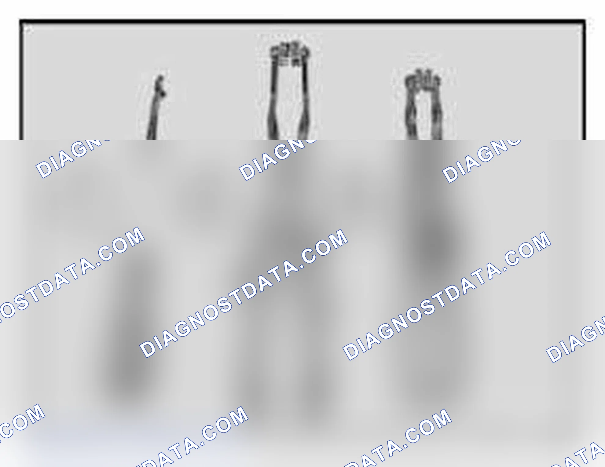 Scheme 18: 17-2053 Pliers