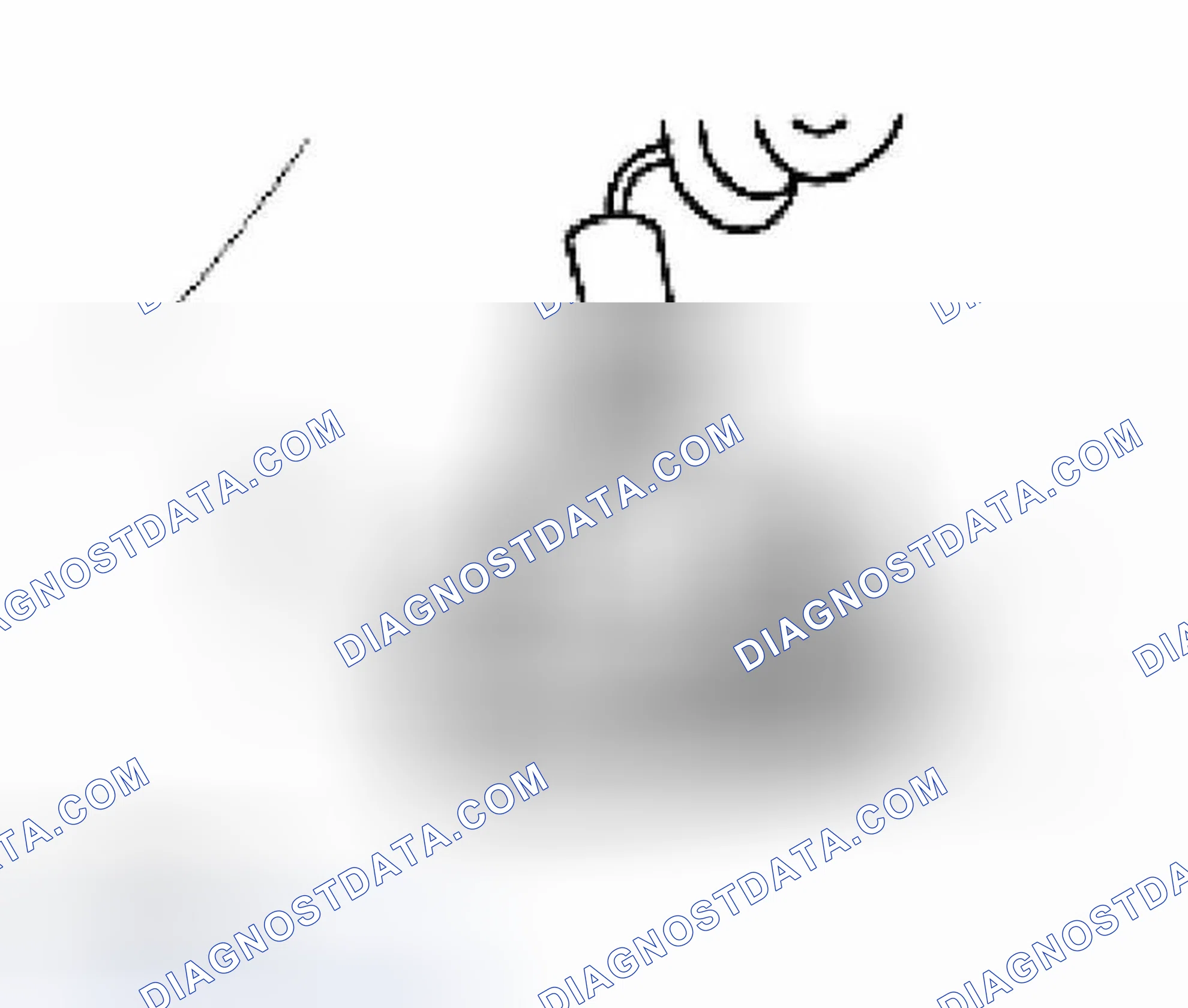 Scheme 5: Removal