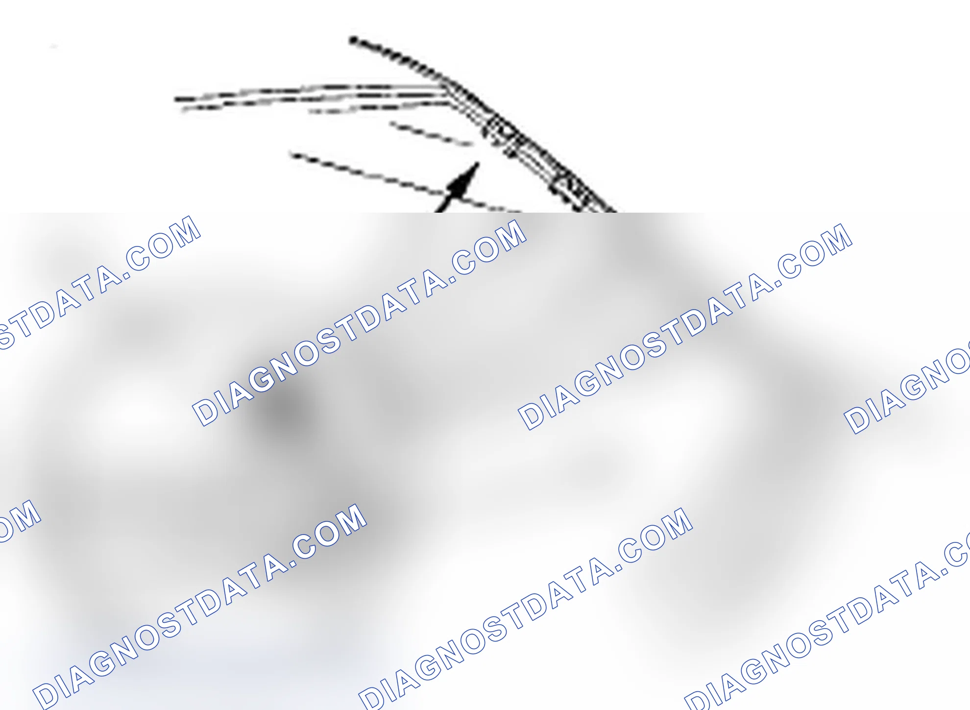 Scheme 188: Body Side Clip Replacement