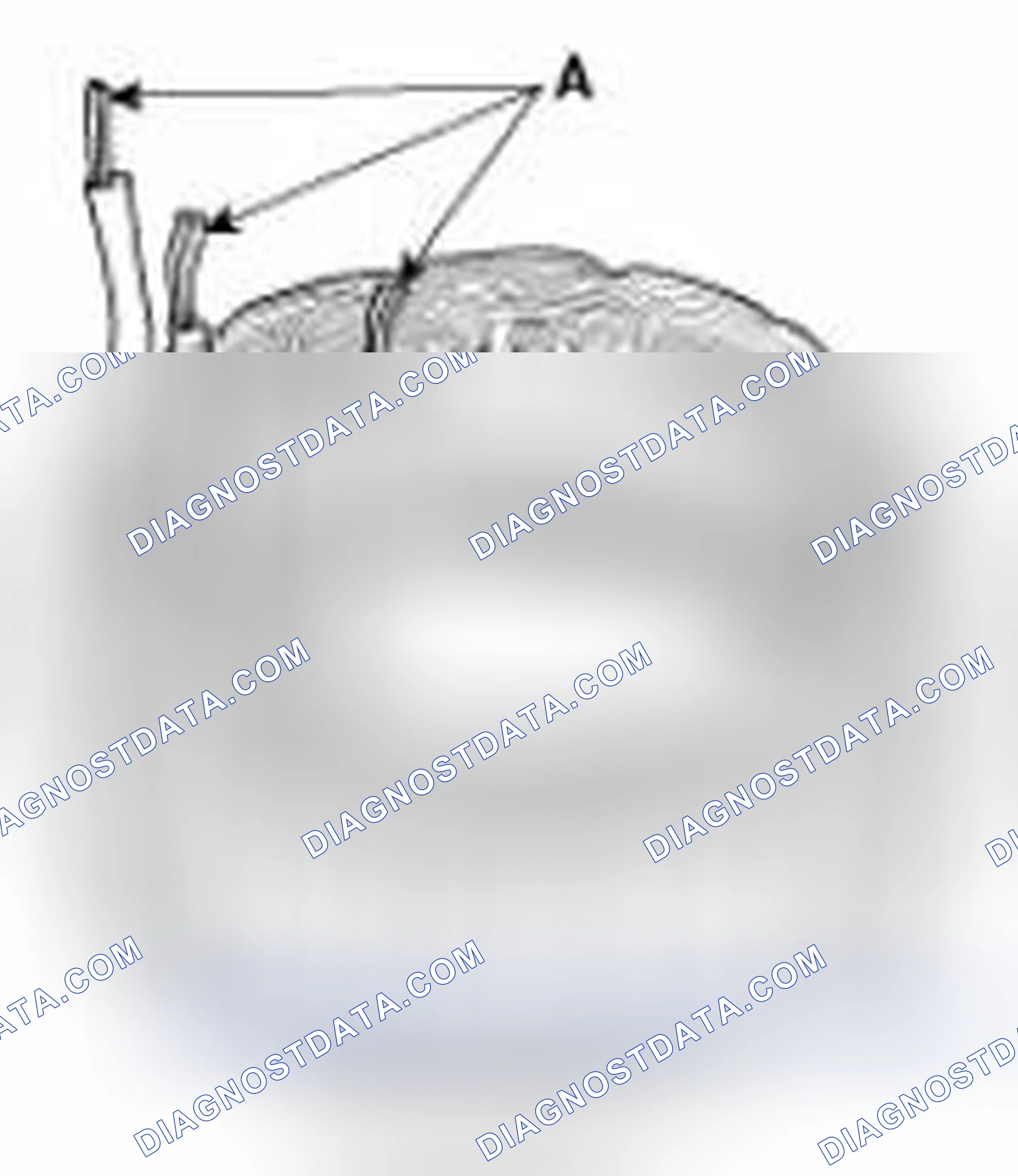 Scheme 50: Inspect Stator