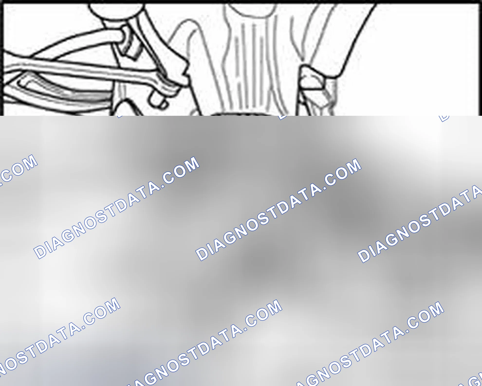 Scheme 11