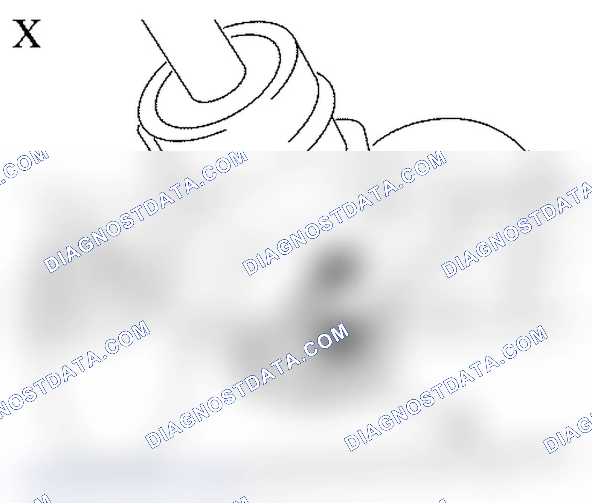 Steering Gear - Noise