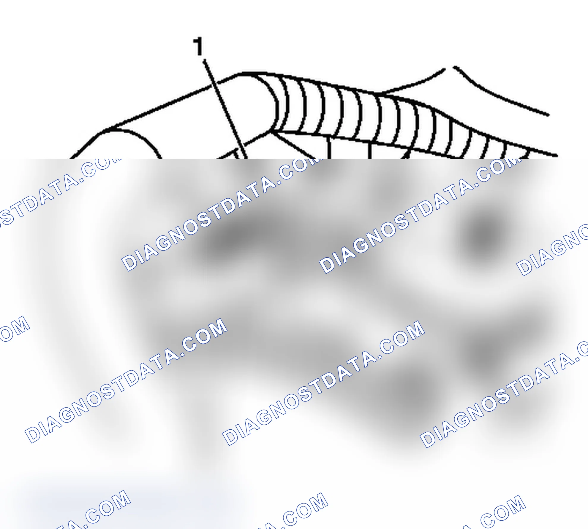 Scheme 15: Removal Procedure