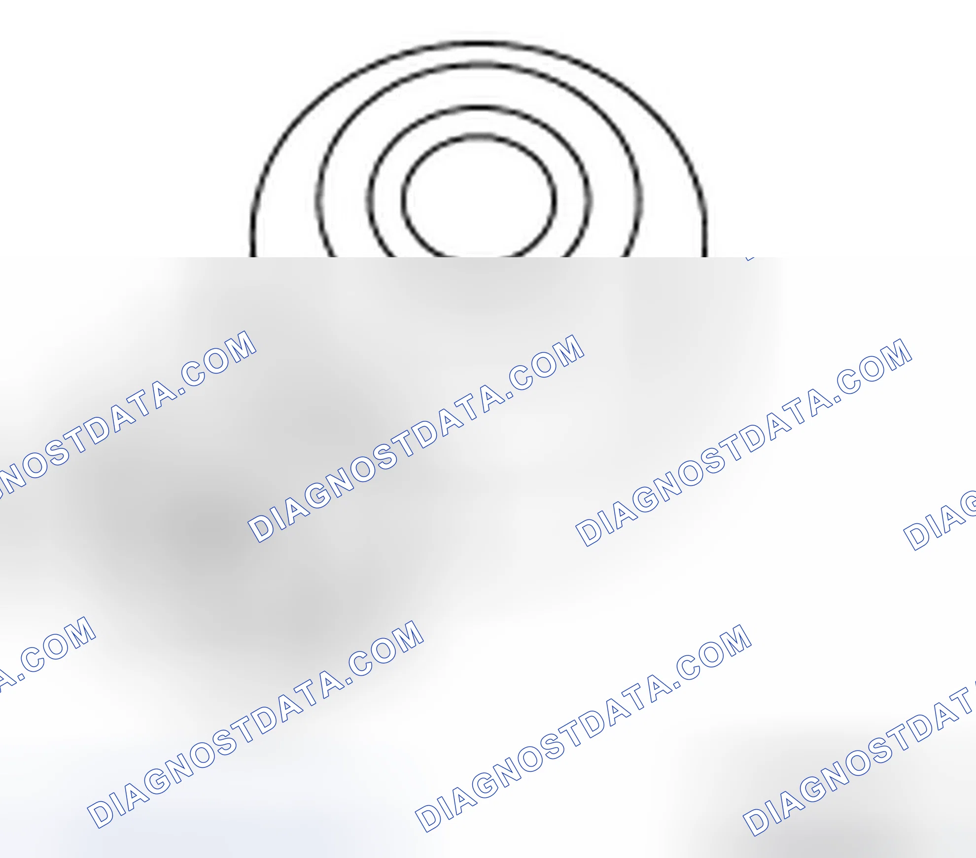 Scheme 85: Knock Sensor