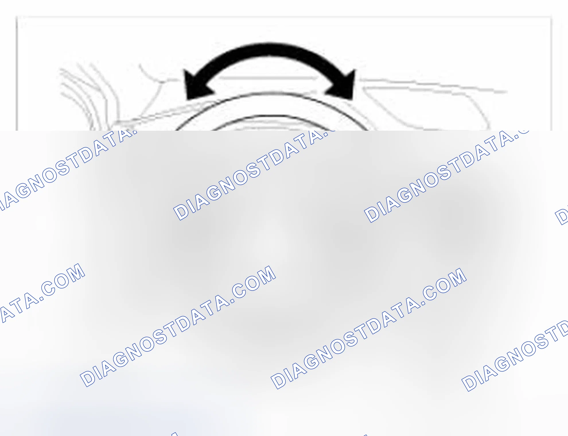 Scheme 3: Steering Wheel Play Inspection