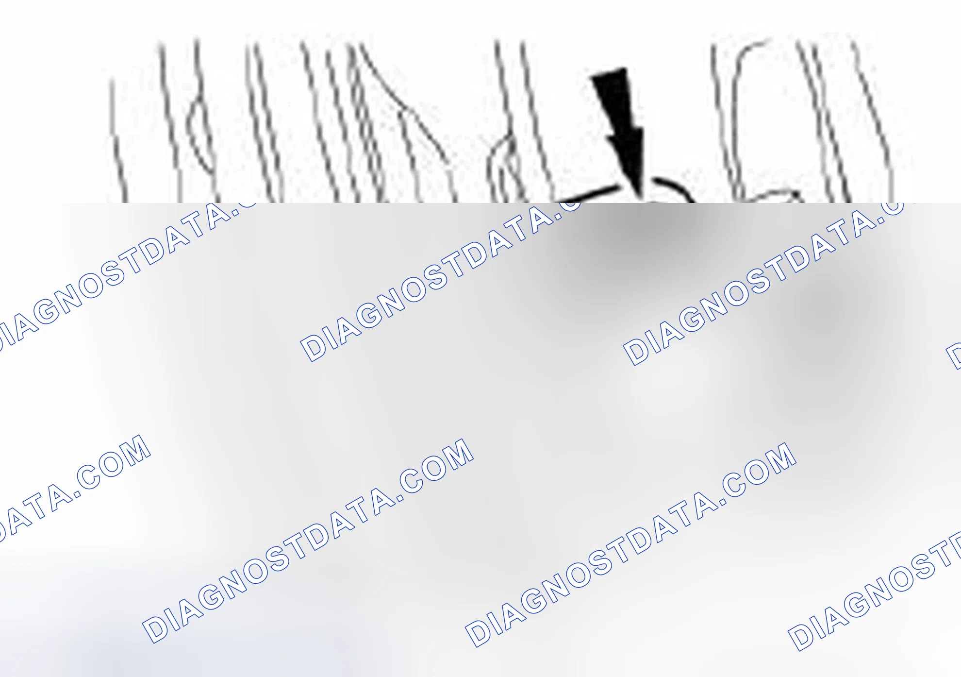 Scheme 32: Removal