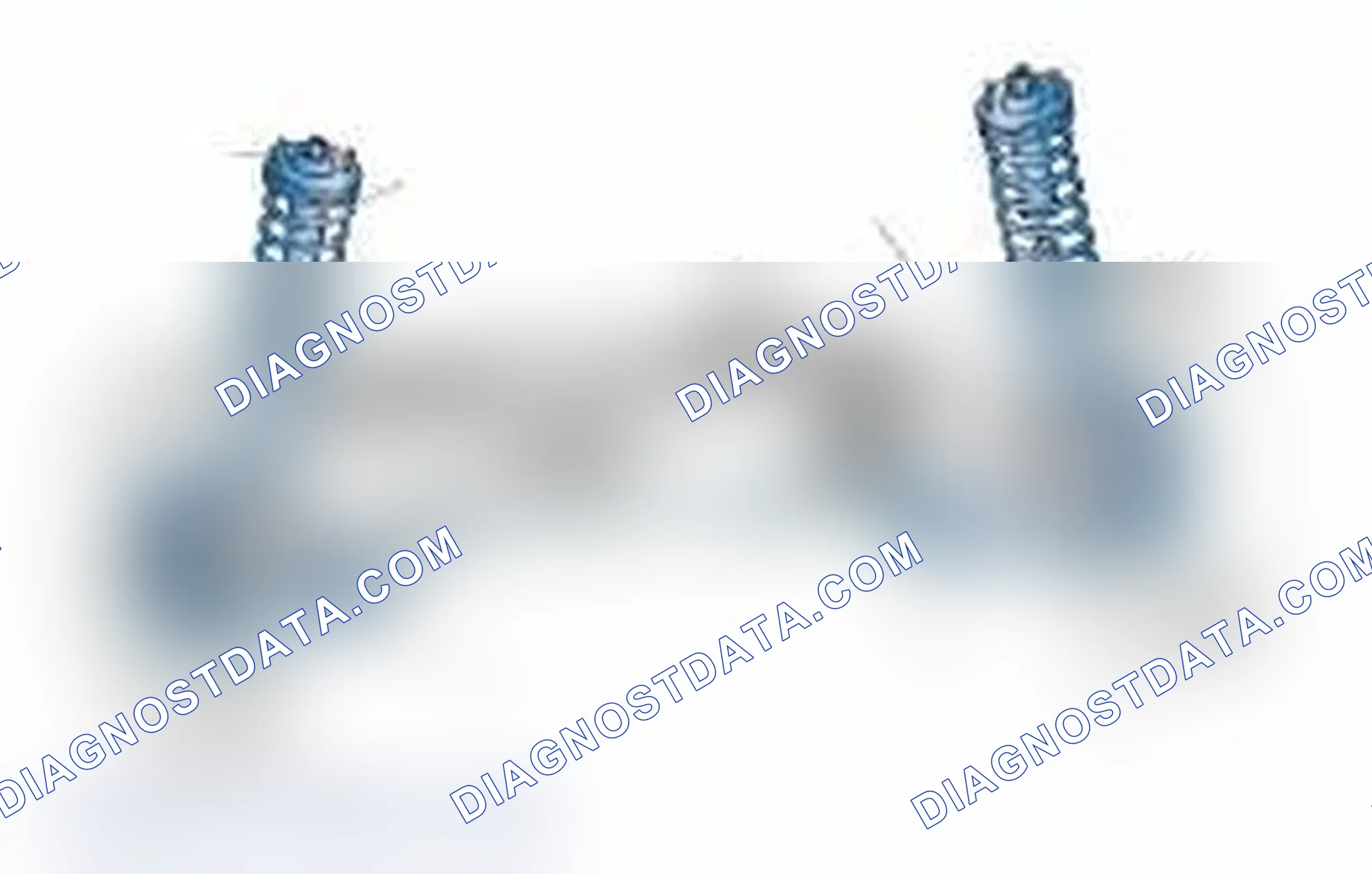 Scheme 25: Typical Front Suspension & Steering Components