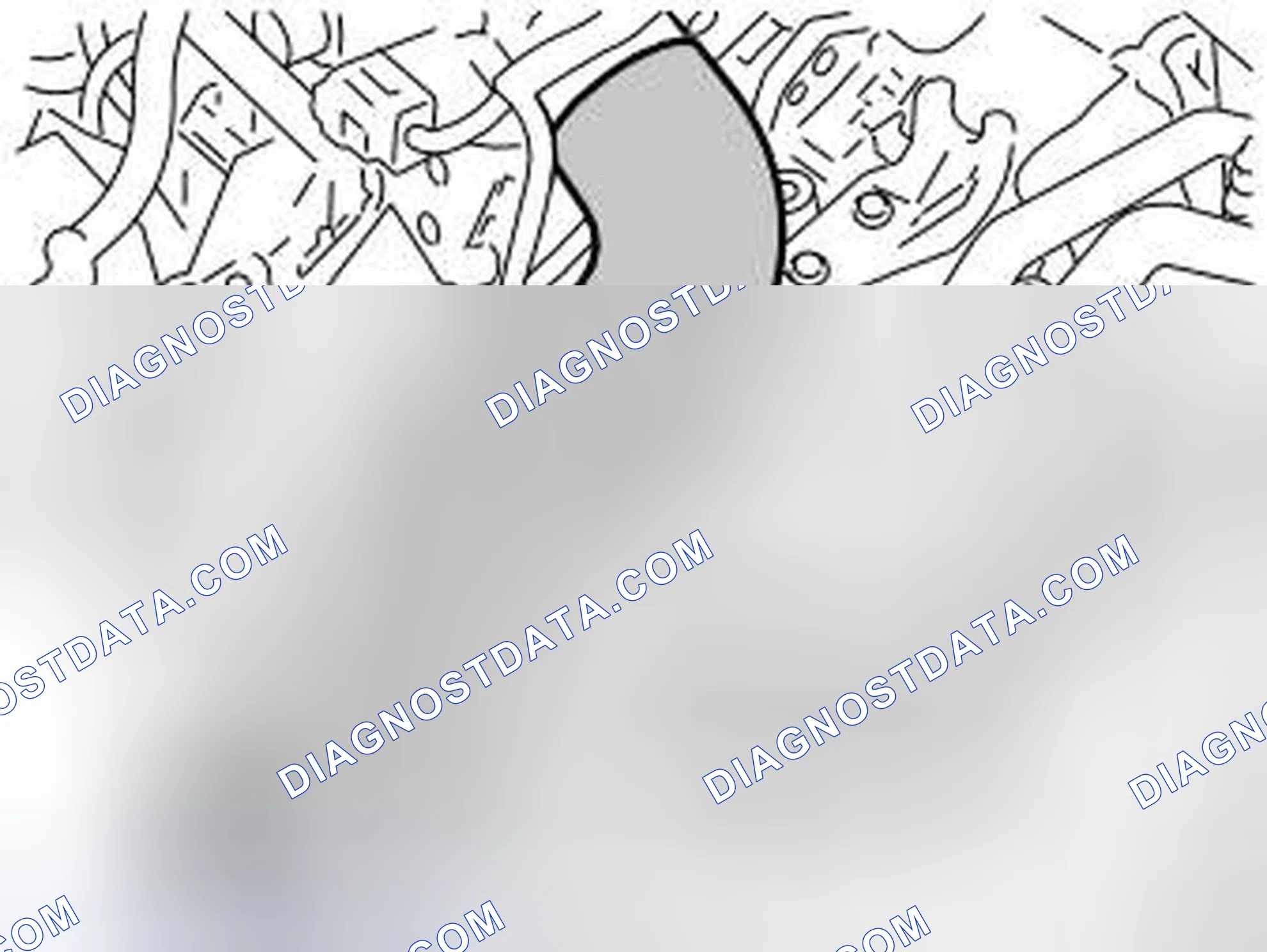 Scheme 276: Remove The EGR Components