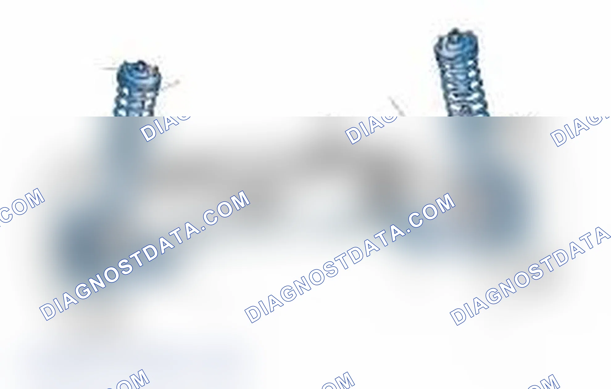 Scheme 25: Typical Front Suspension & Steering Components