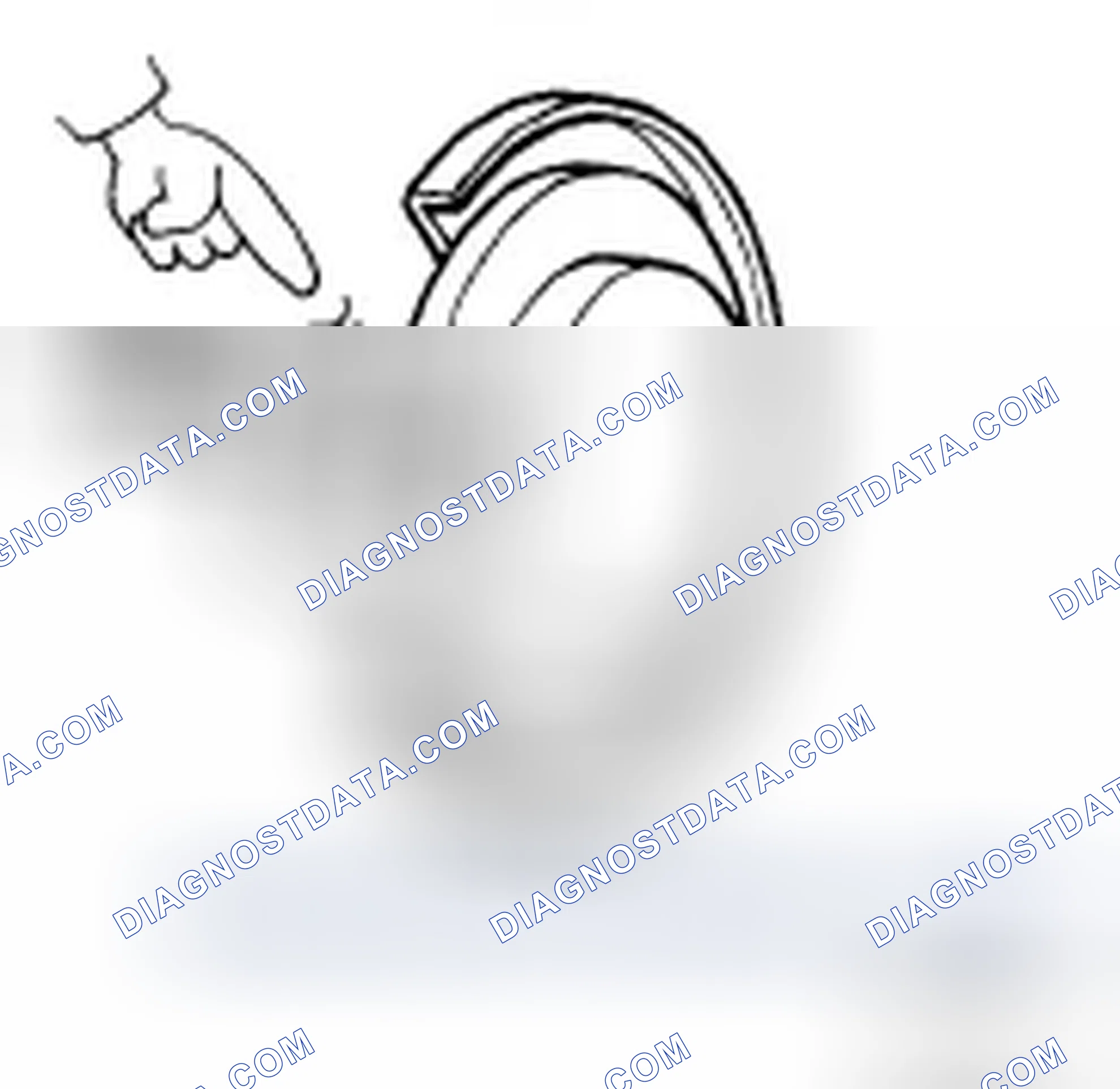 Fig. 64: Checking Disc Brake Rotor