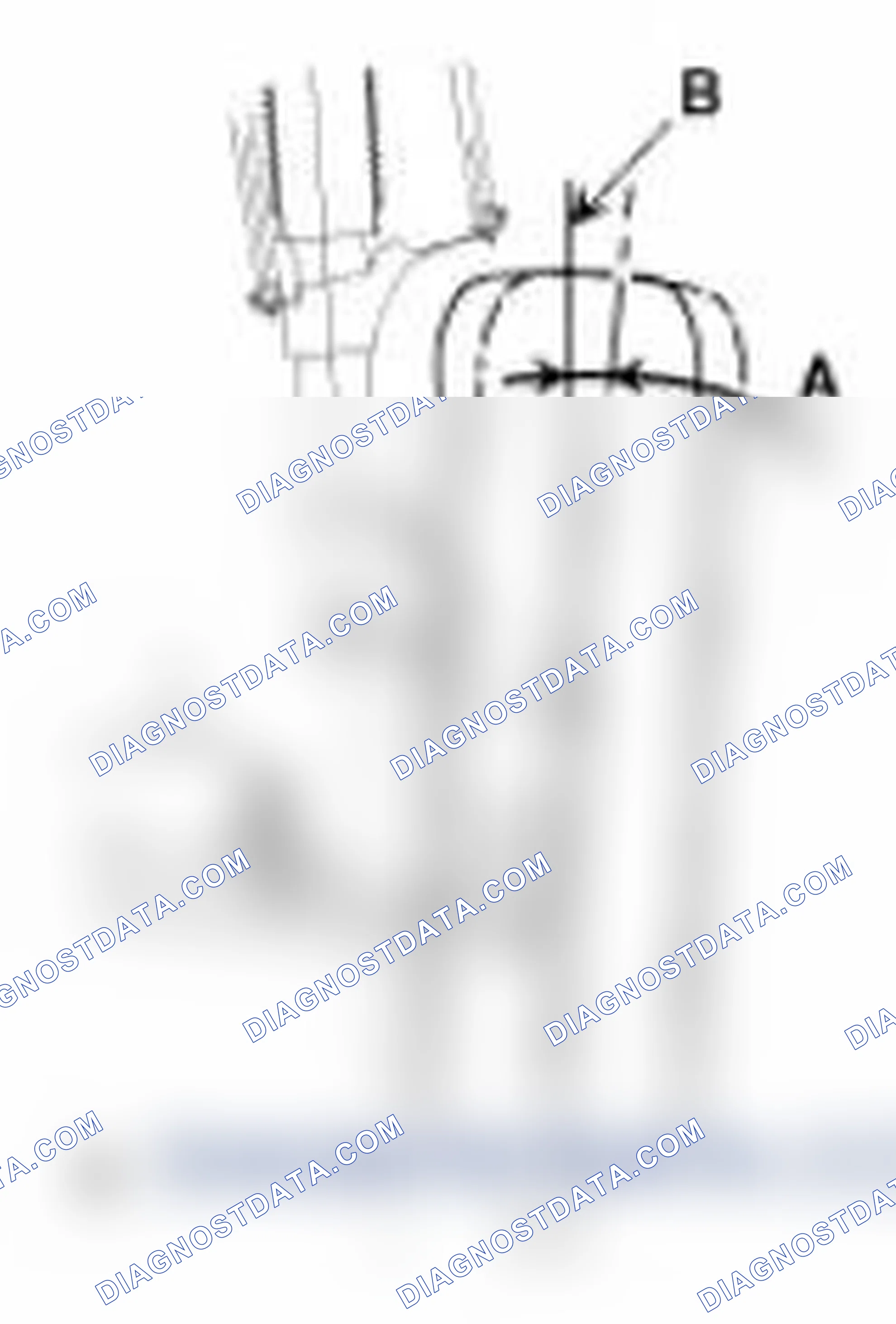 Scheme 4: Camber