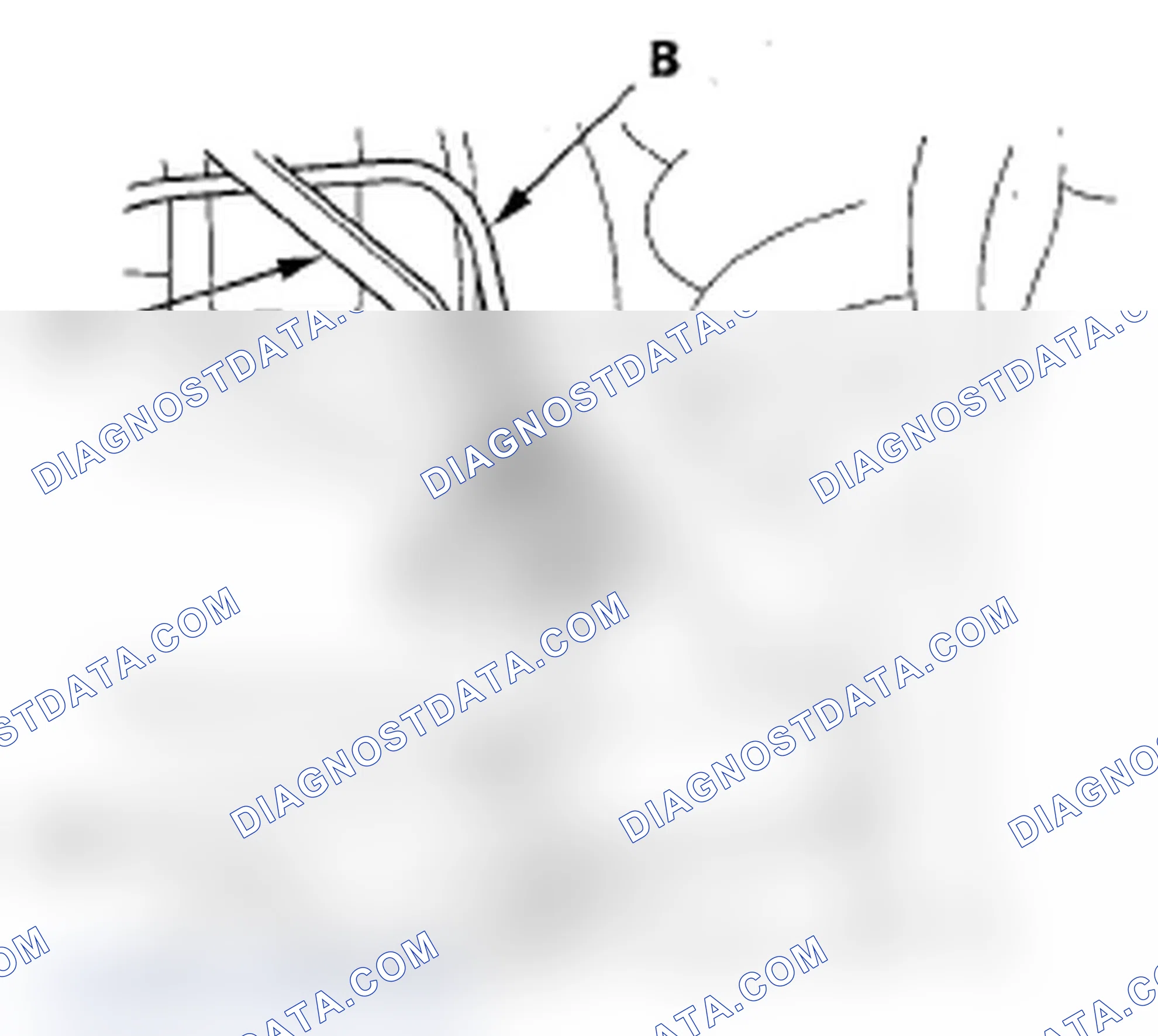 Scheme 70: Brake Hose Replacement