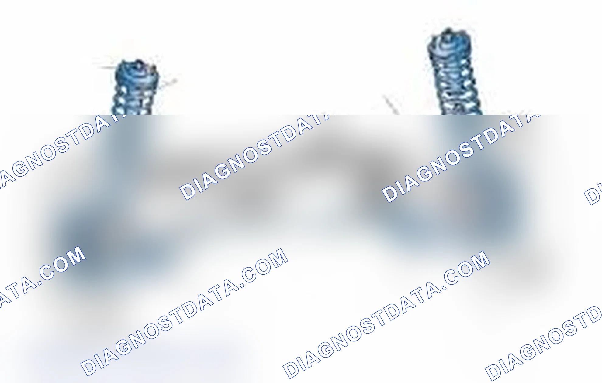 Scheme 25: Typical Front Suspension & Steering Components