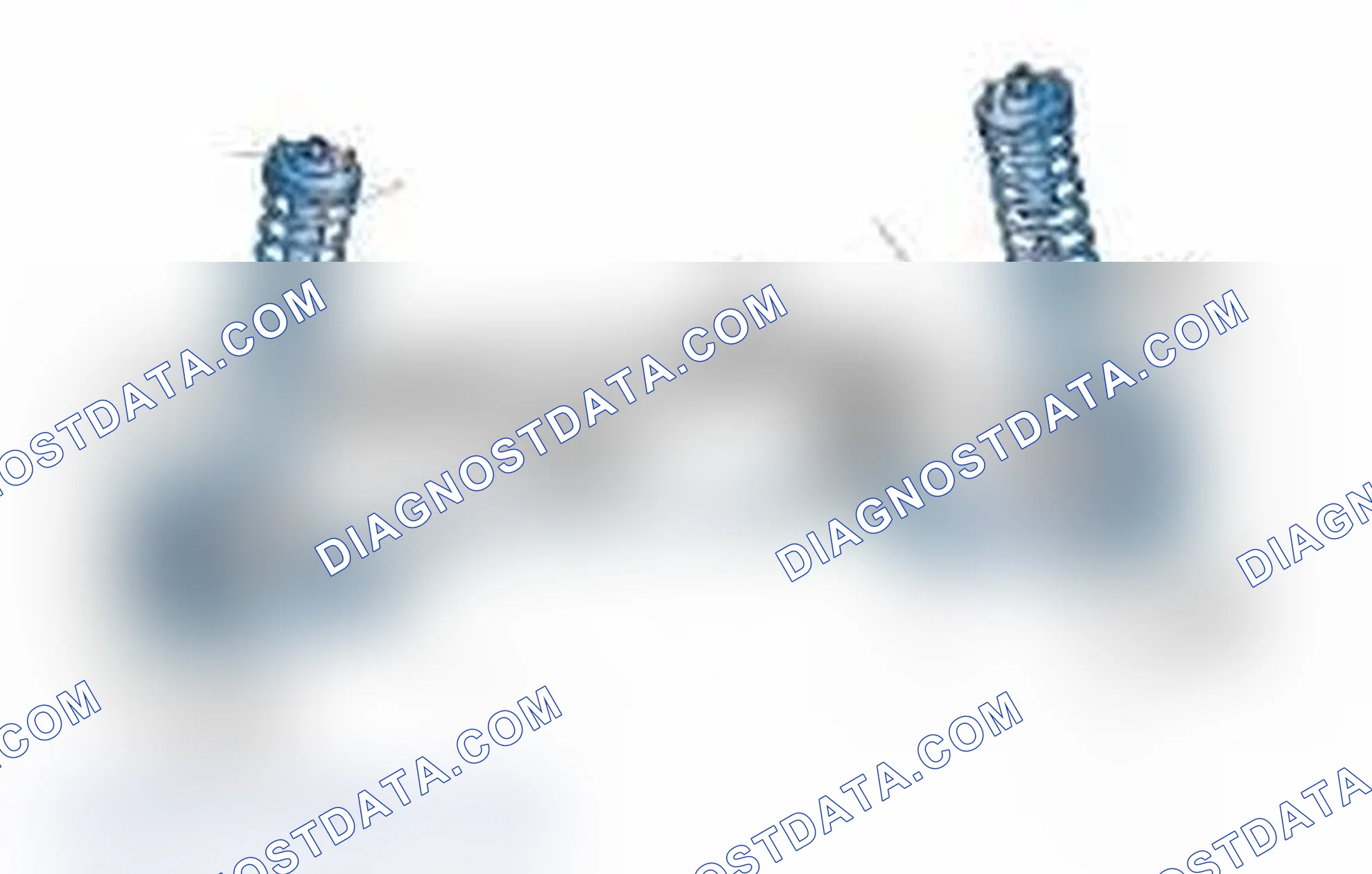Scheme 25: Typical Front Suspension & Steering Components
