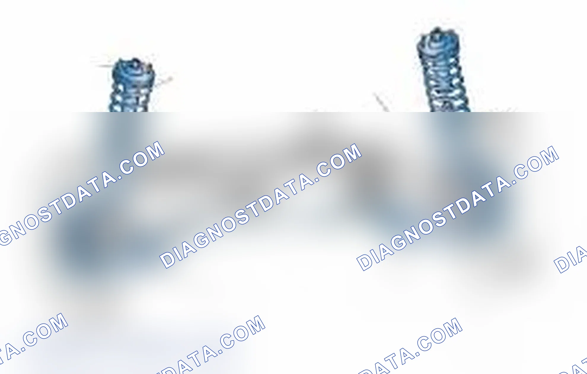 Scheme 25: Typical Front Suspension & Steering Components