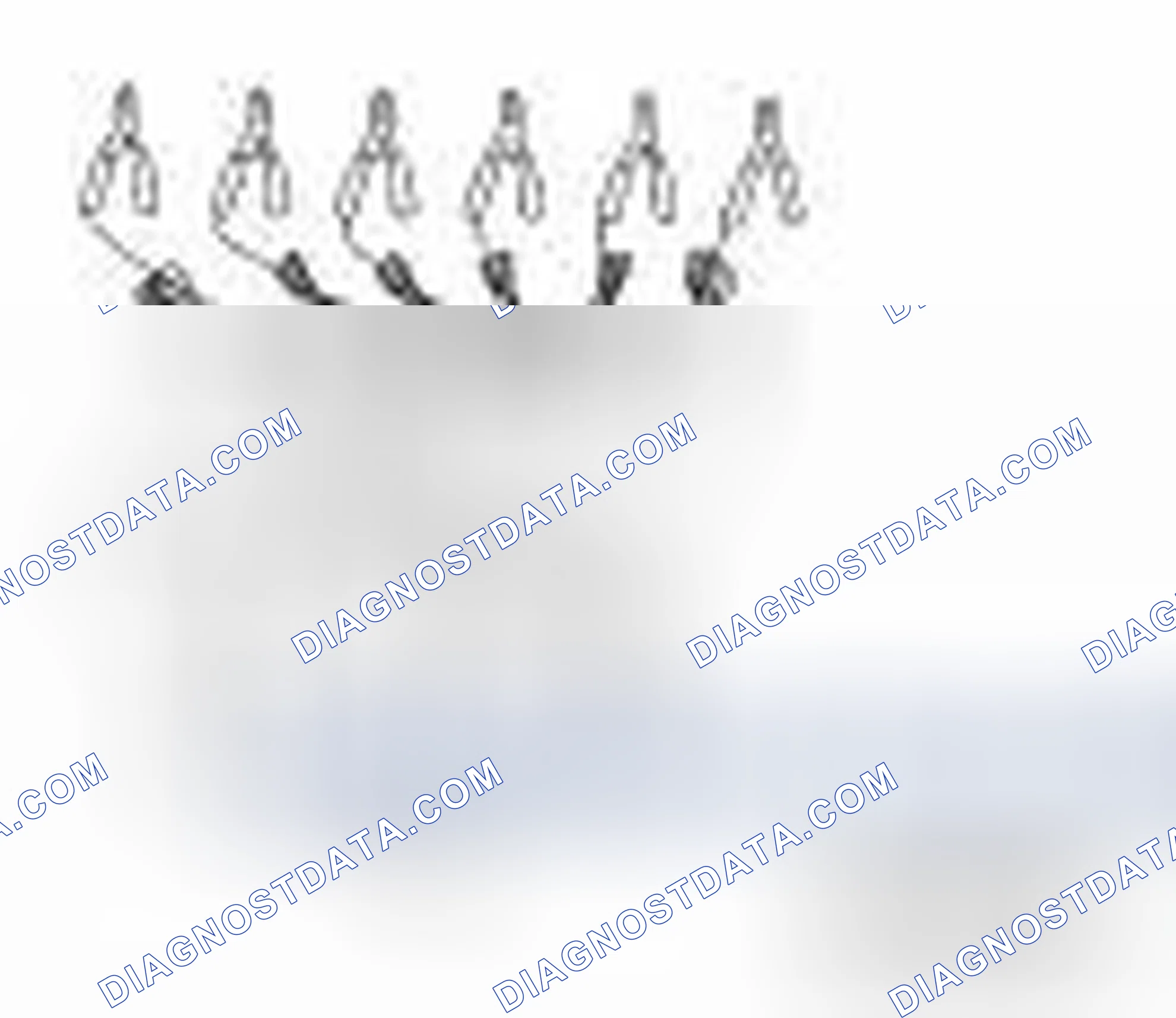 Scheme 29: Special Service Tool