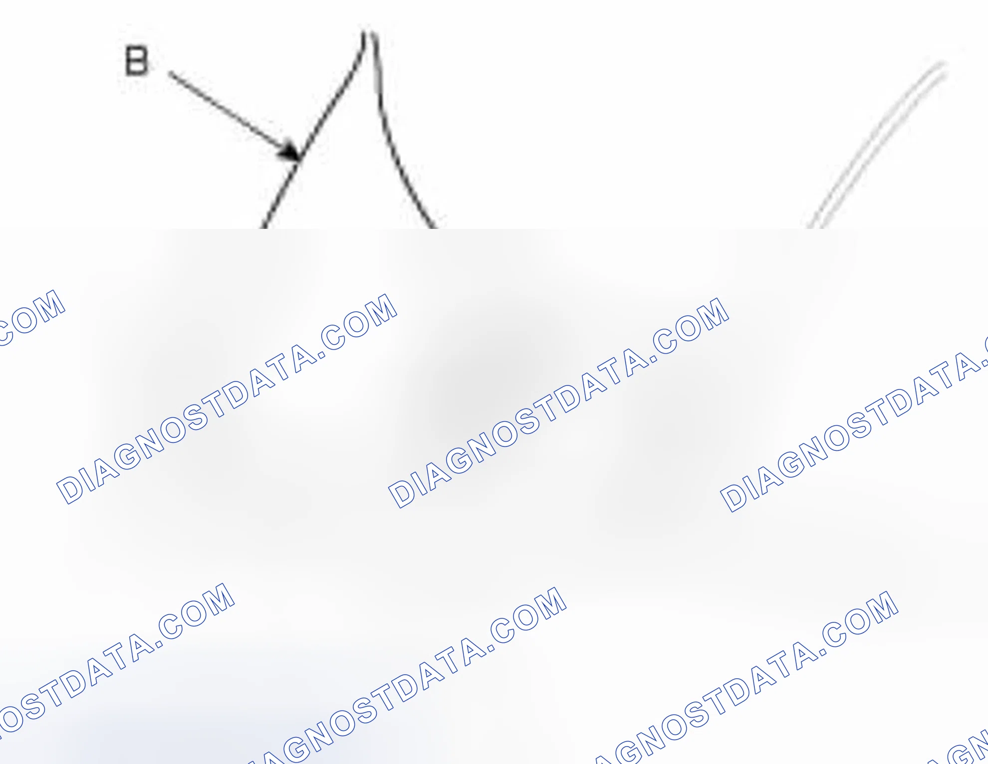 Scheme 69: Rear Pillar Trim Replacement