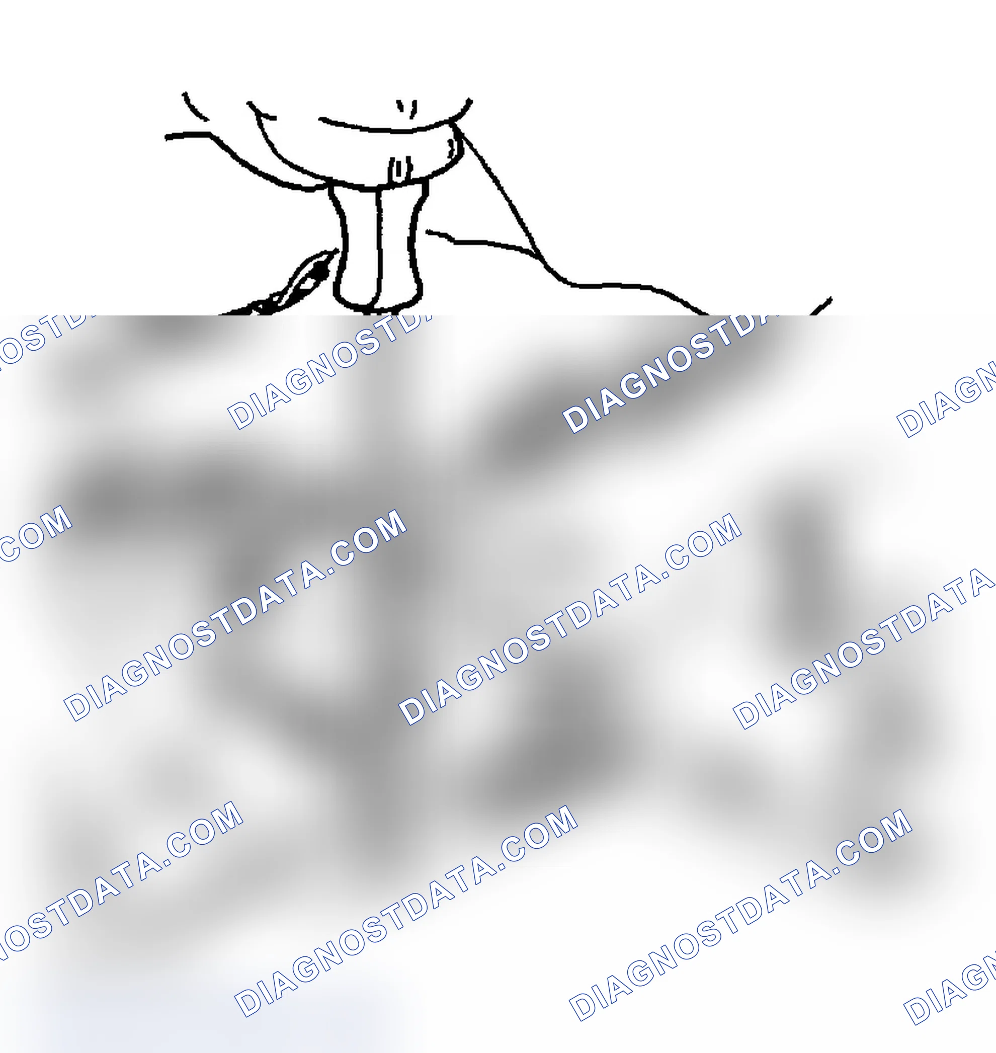 Scheme 40: FORWARD BAND SERVO