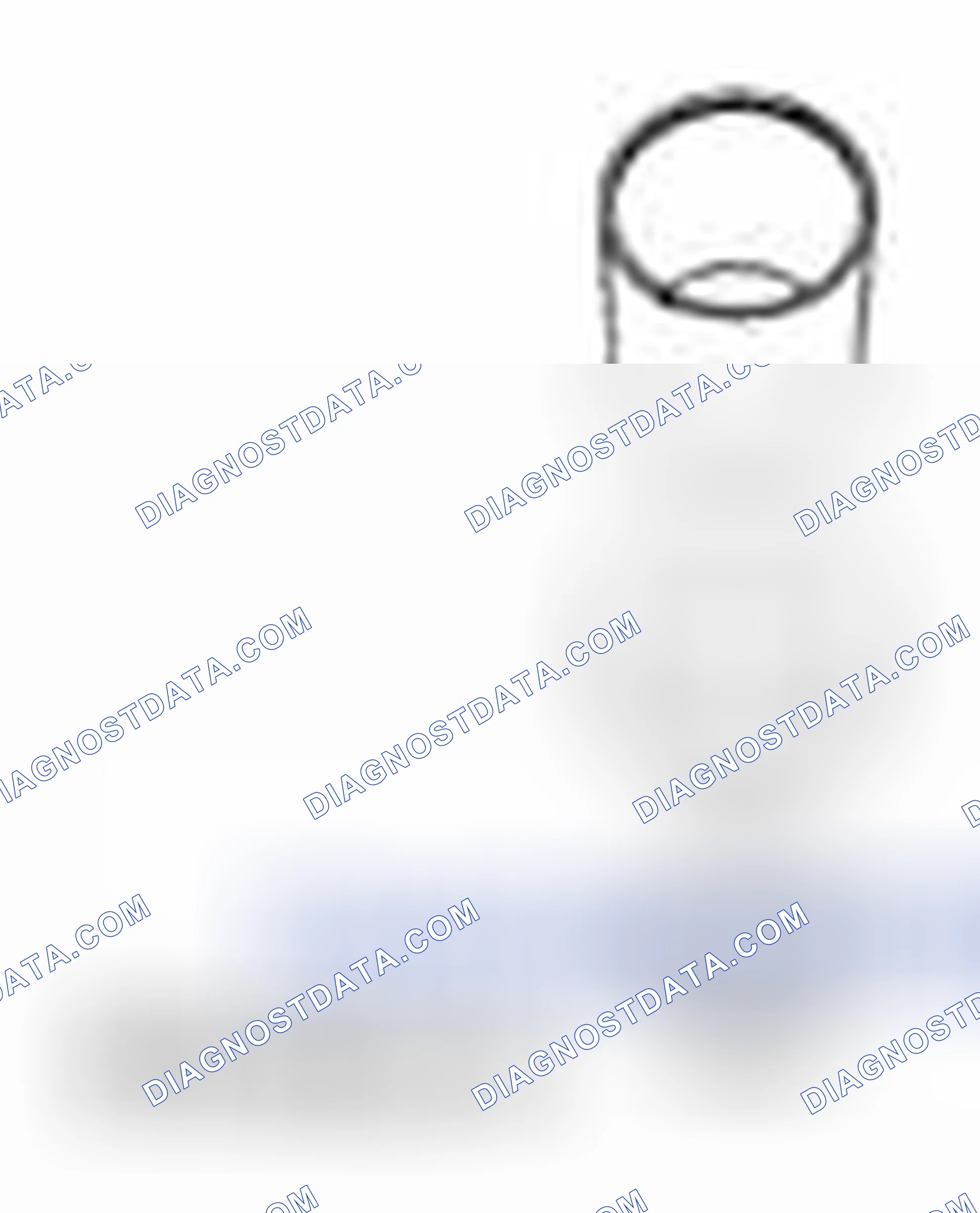 Scheme 50: Subframe Bushings - Differential, Rear