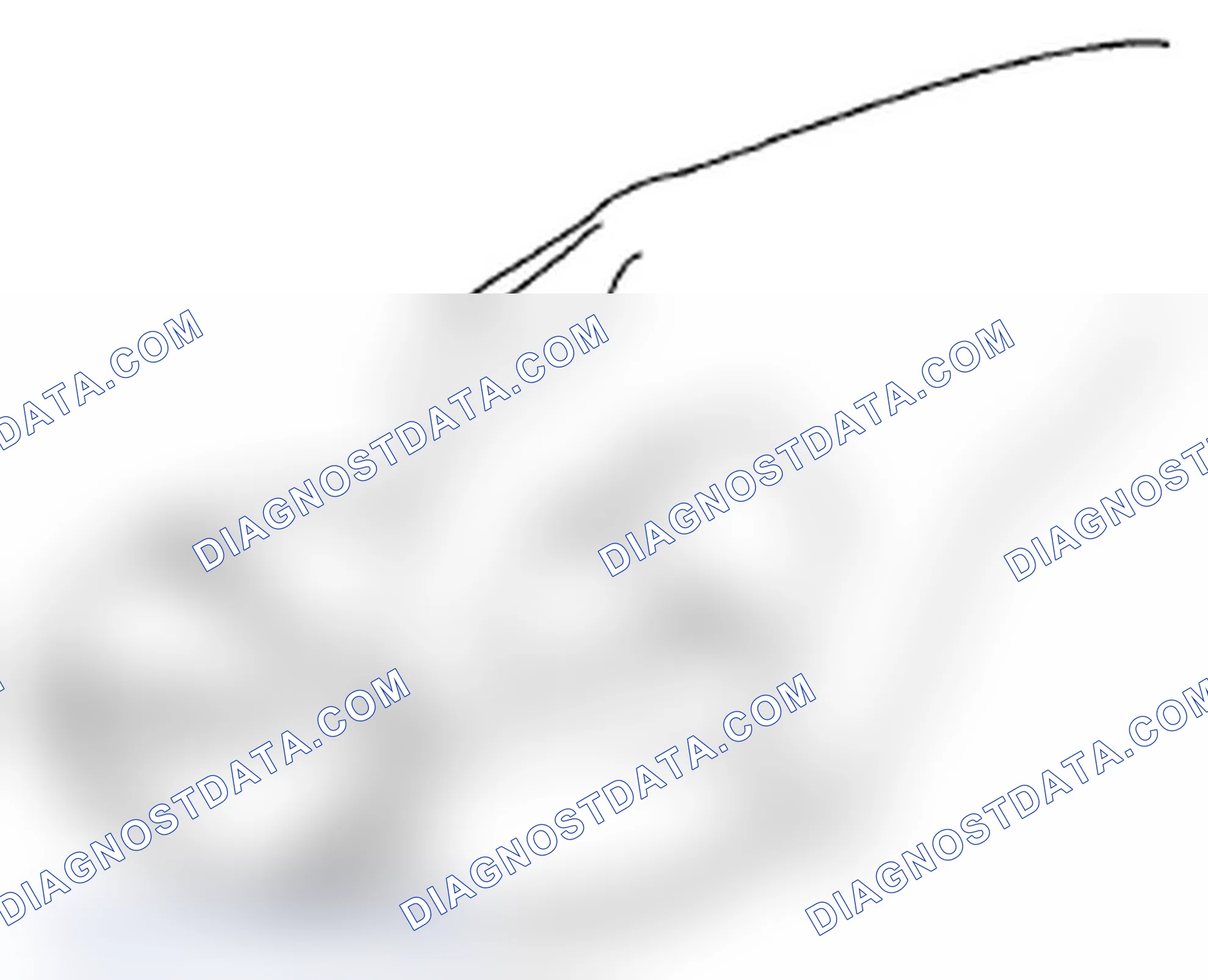 Scheme 12: Disc Handing and Cleaning